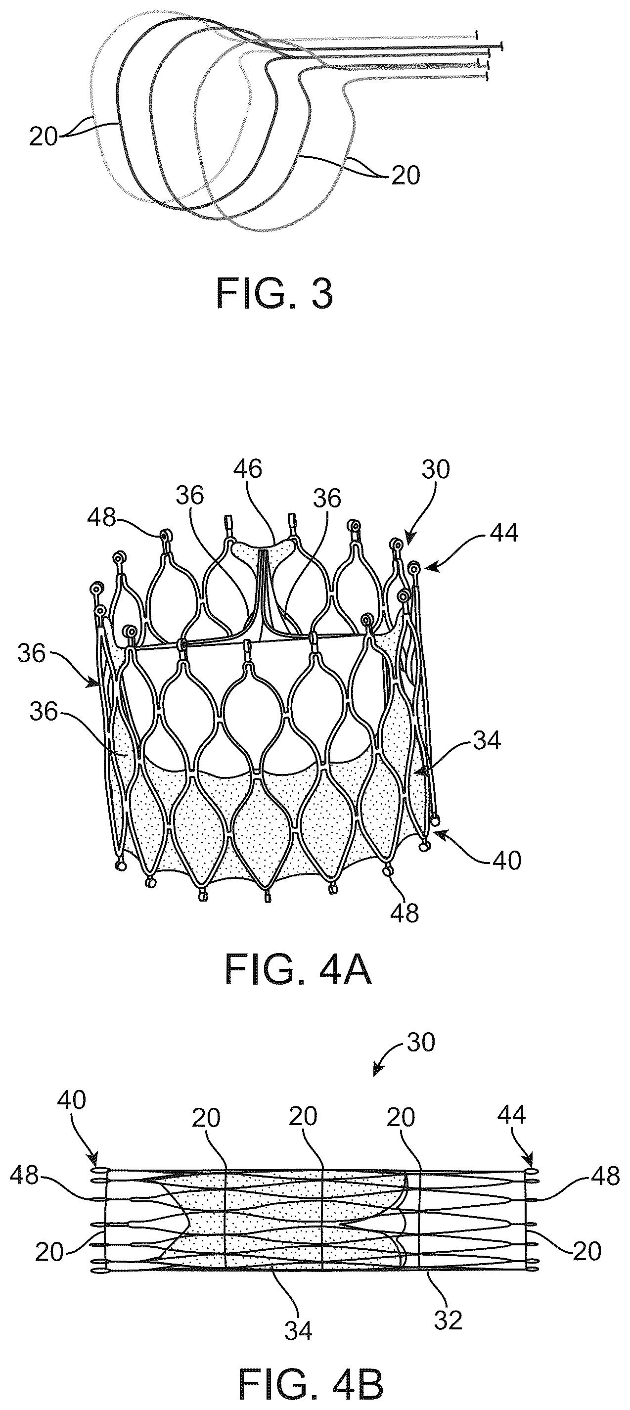 Patent US12097117 Figure 2 – Transcatheter prosthetic heart valve delivery system with distal cutting assembly