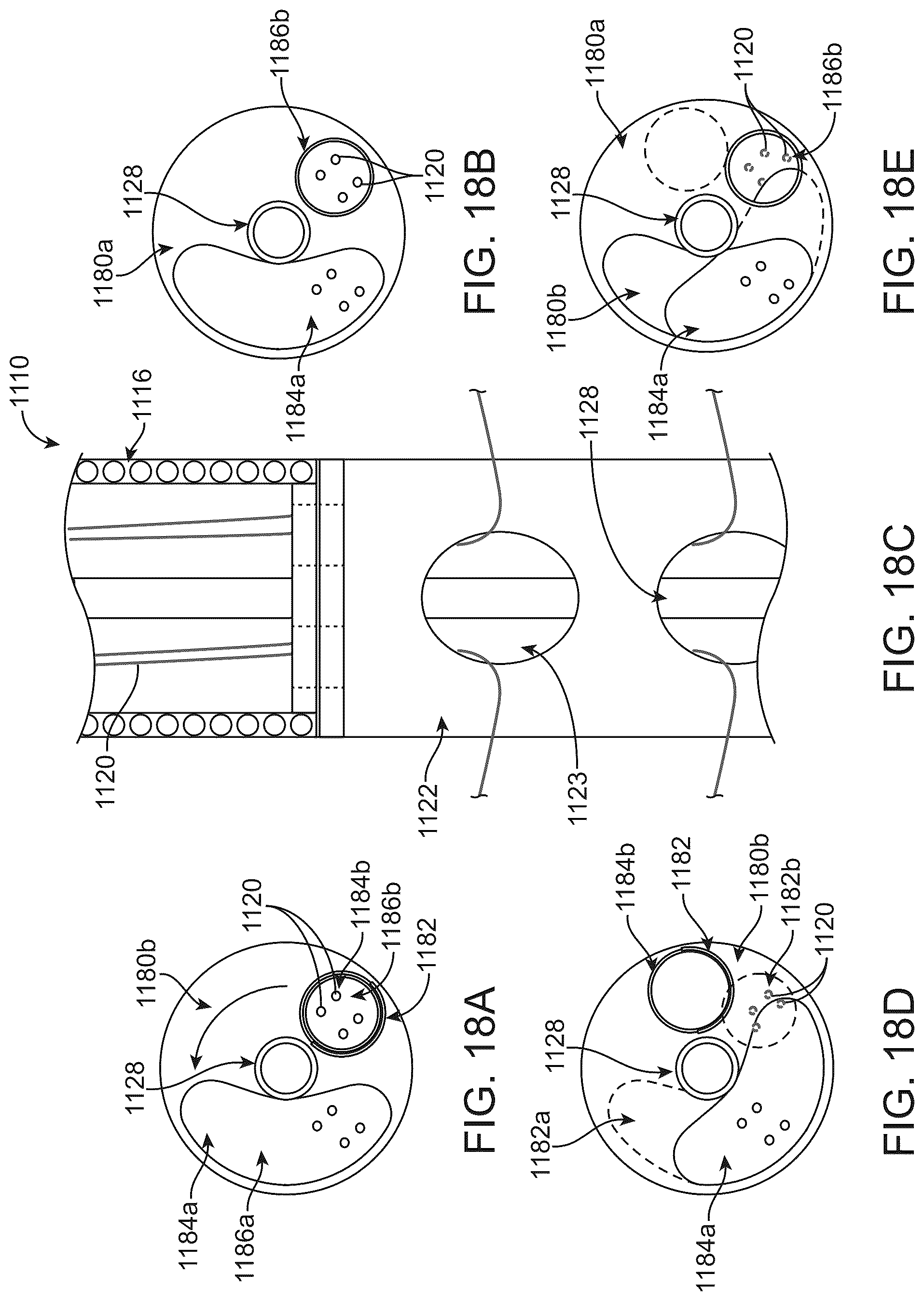Patent US12097117 Figure 15 – Transcatheter prosthetic heart valve delivery system with distal cutting assembly