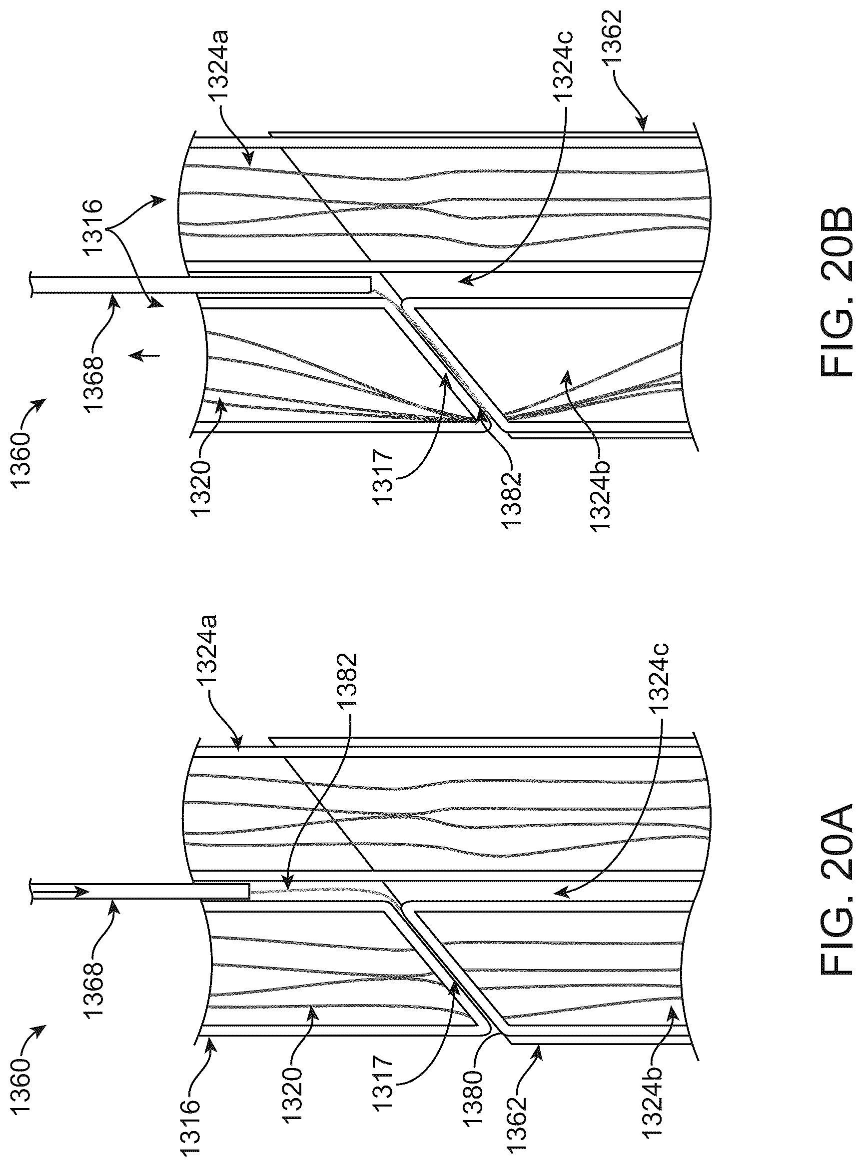 Patent US12097117 Figure 17 – Transcatheter prosthetic heart valve delivery system with distal cutting assembly