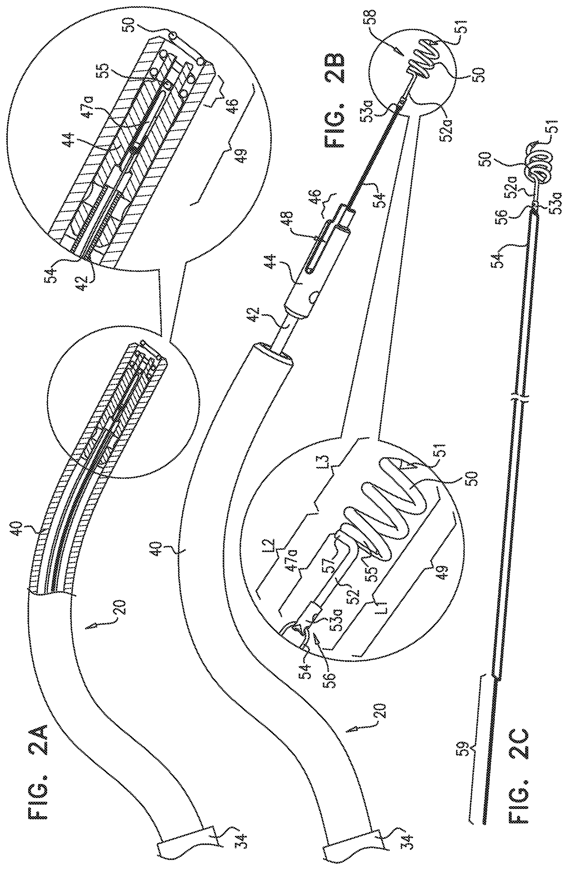 Patent US12097118 Figure 4 – Tissue anchor for heart implant