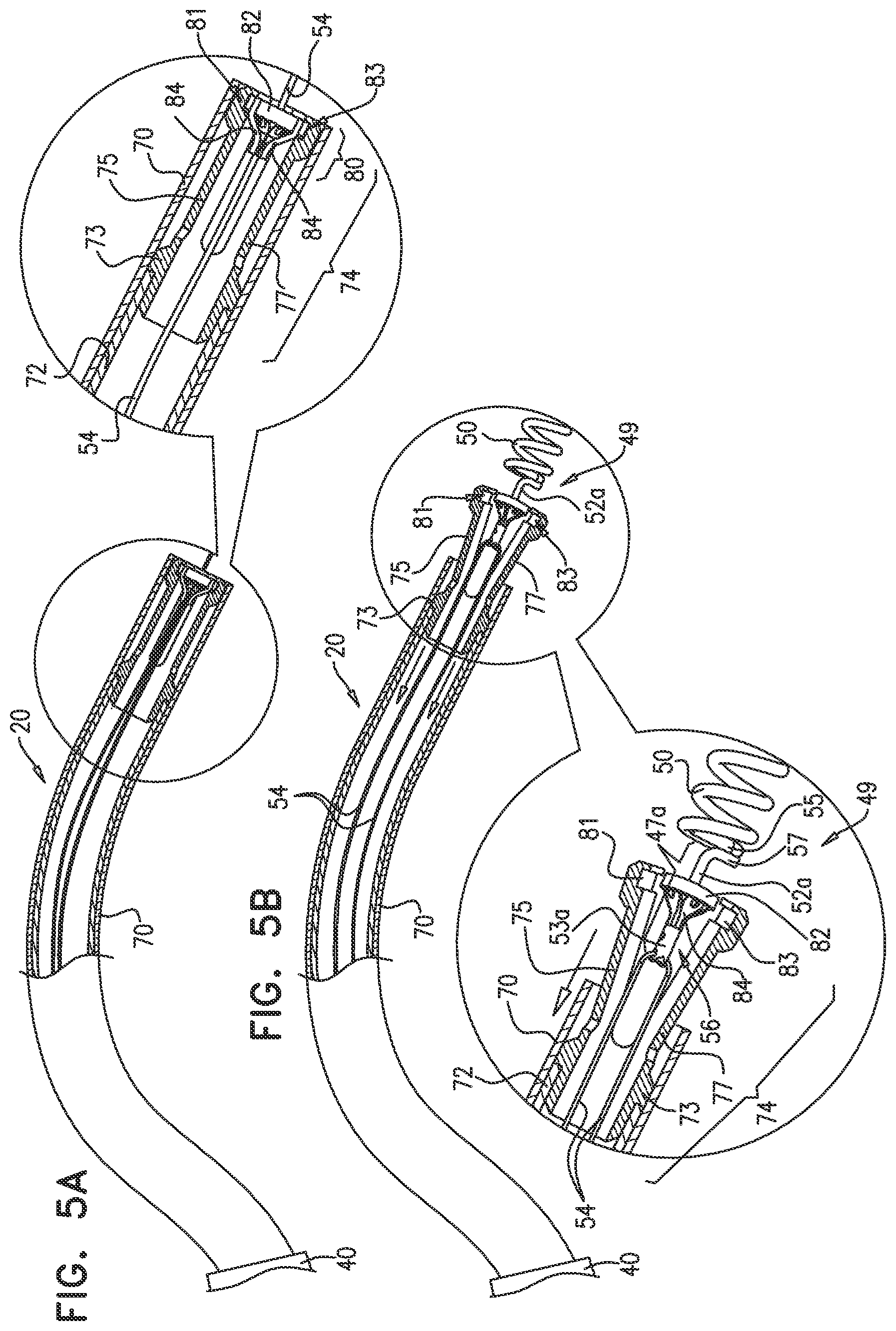 Patent US12097118 Figure 7 – Tissue anchor for heart implant