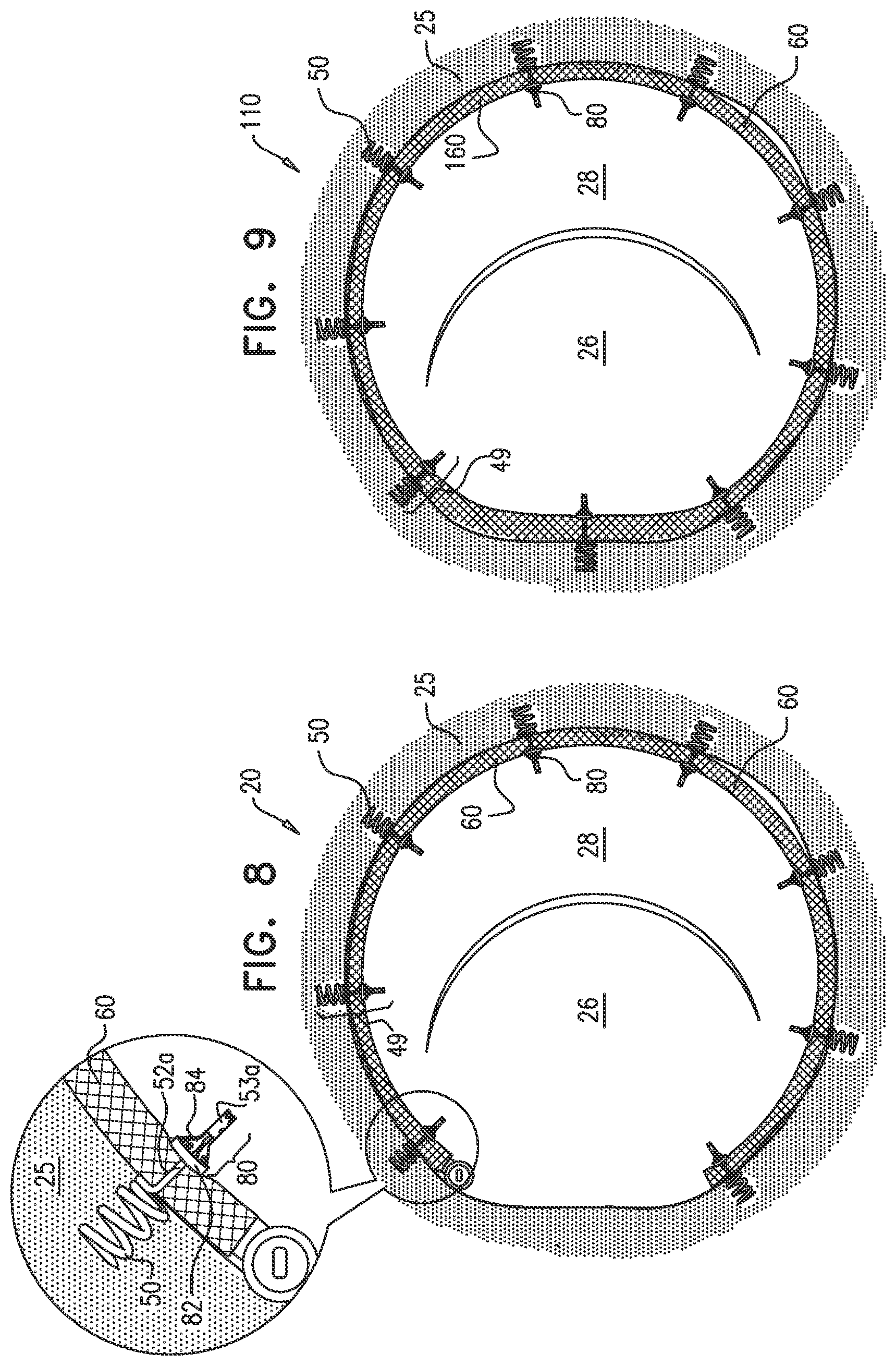 Patent US12097118 Figure 9 – Tissue anchor for heart implant