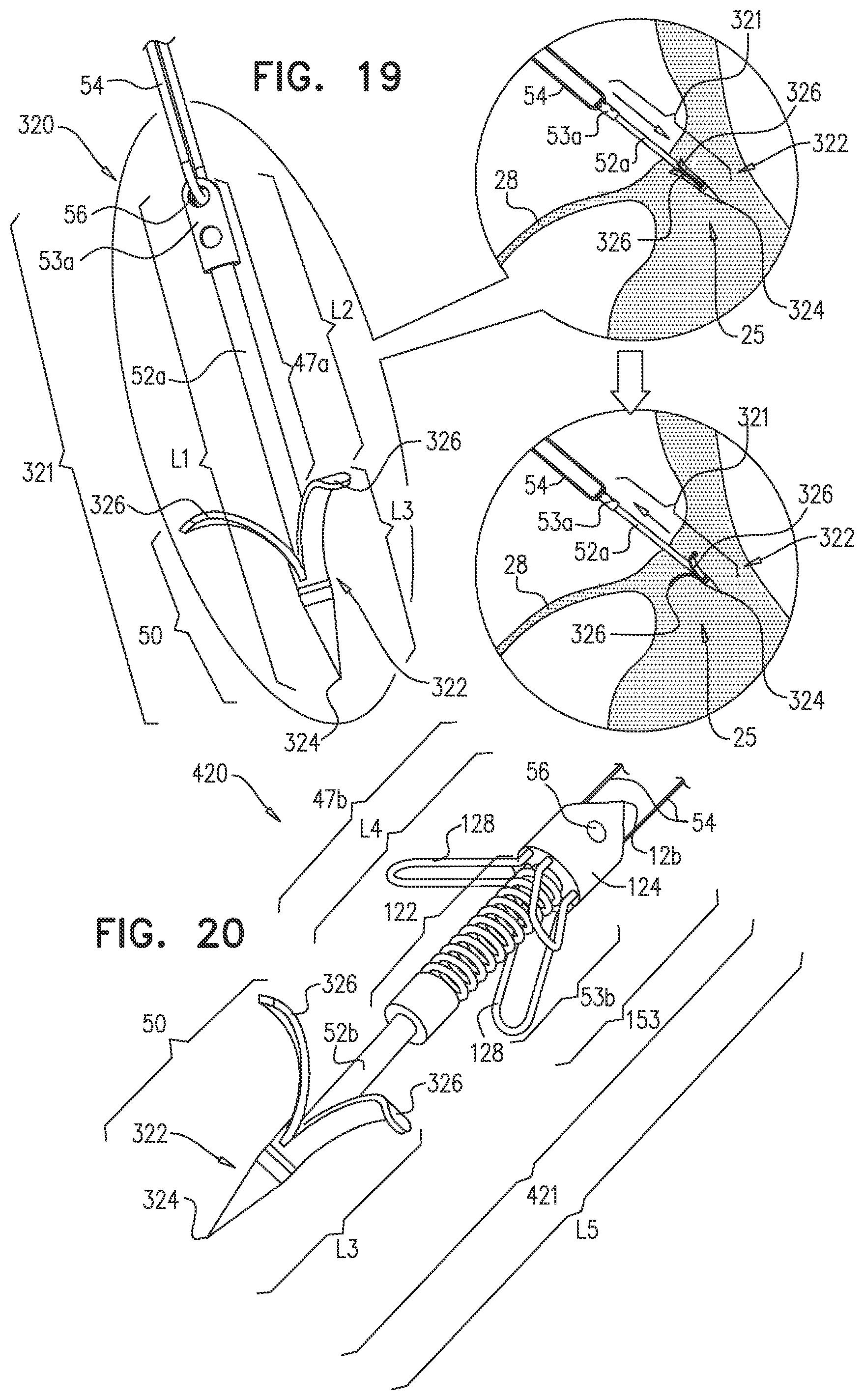 Patent US12097118 Figure 20 – Tissue anchor for heart implant