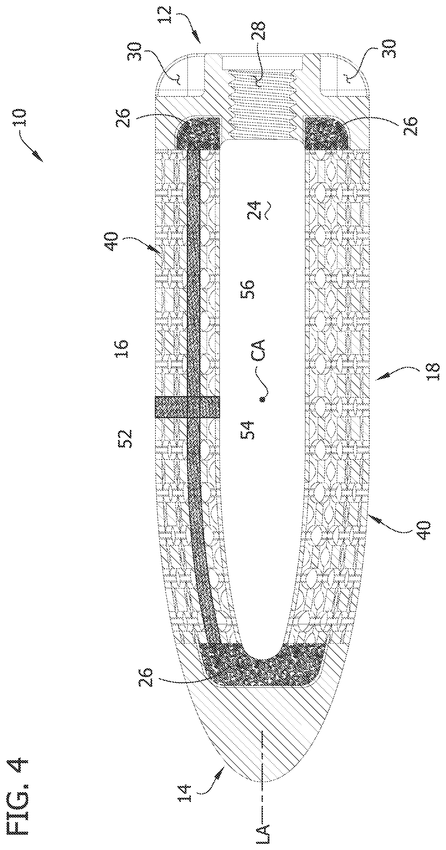Patent US12097119 Figure 4 – Interbody spacer for spinal fusion