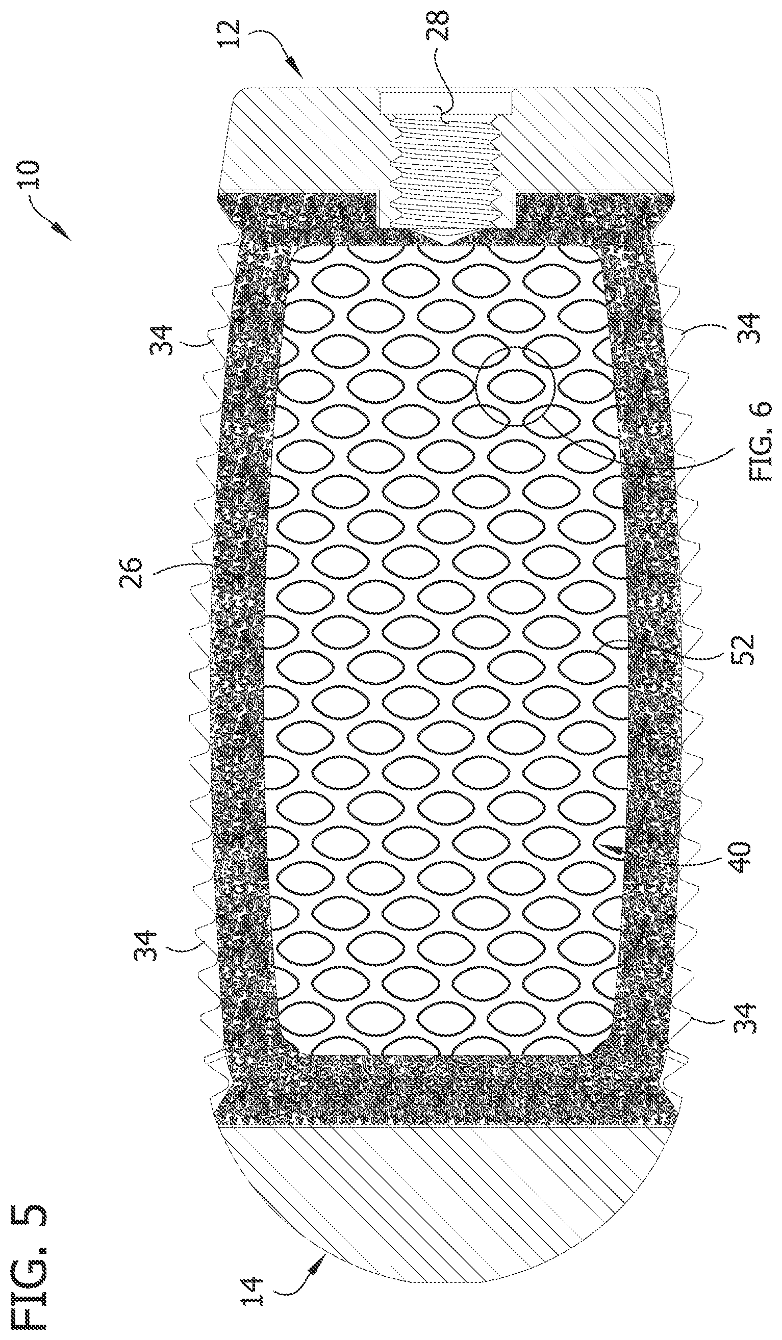 Patent US12097119 Figure 5 – Interbody spacer for spinal fusion