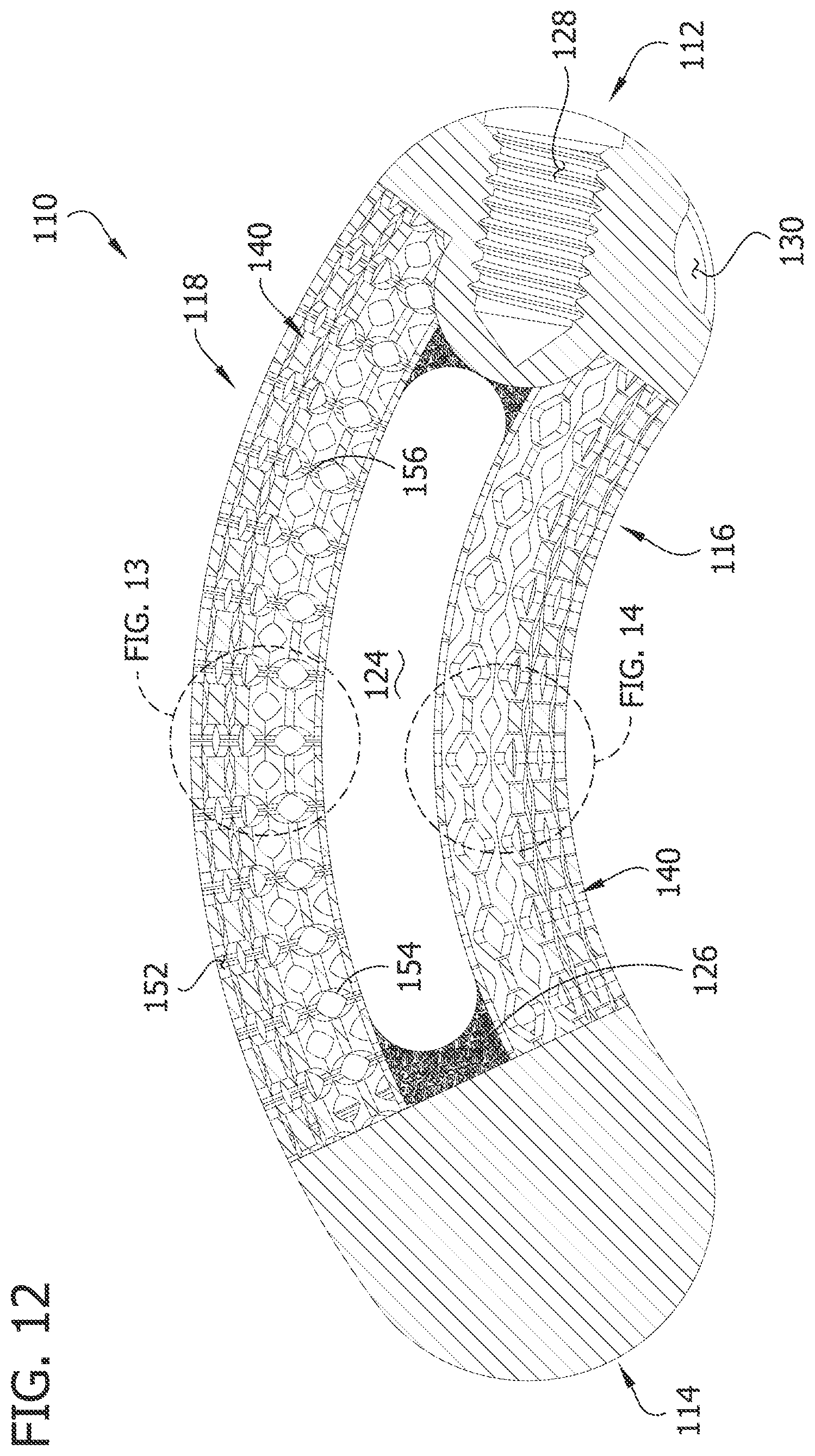 Patent US12097119 Figure 12 – Interbody spacer for spinal fusion