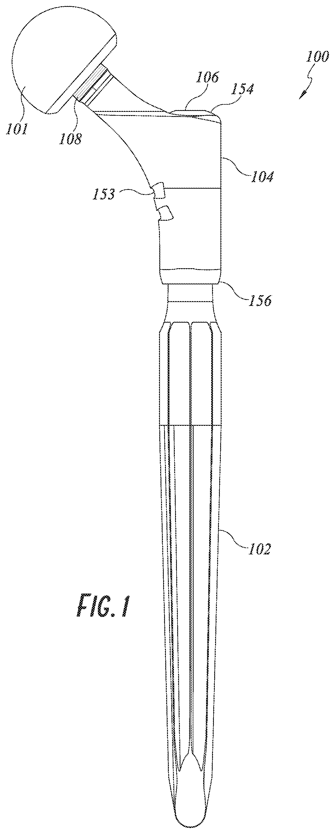 Patent US12097121 Figure 1 – Hip implant system