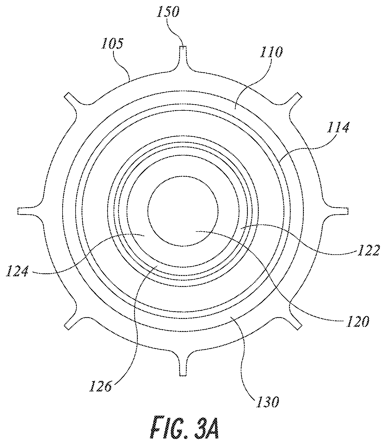 Patent US12097121 Figure 3 – Hip implant system