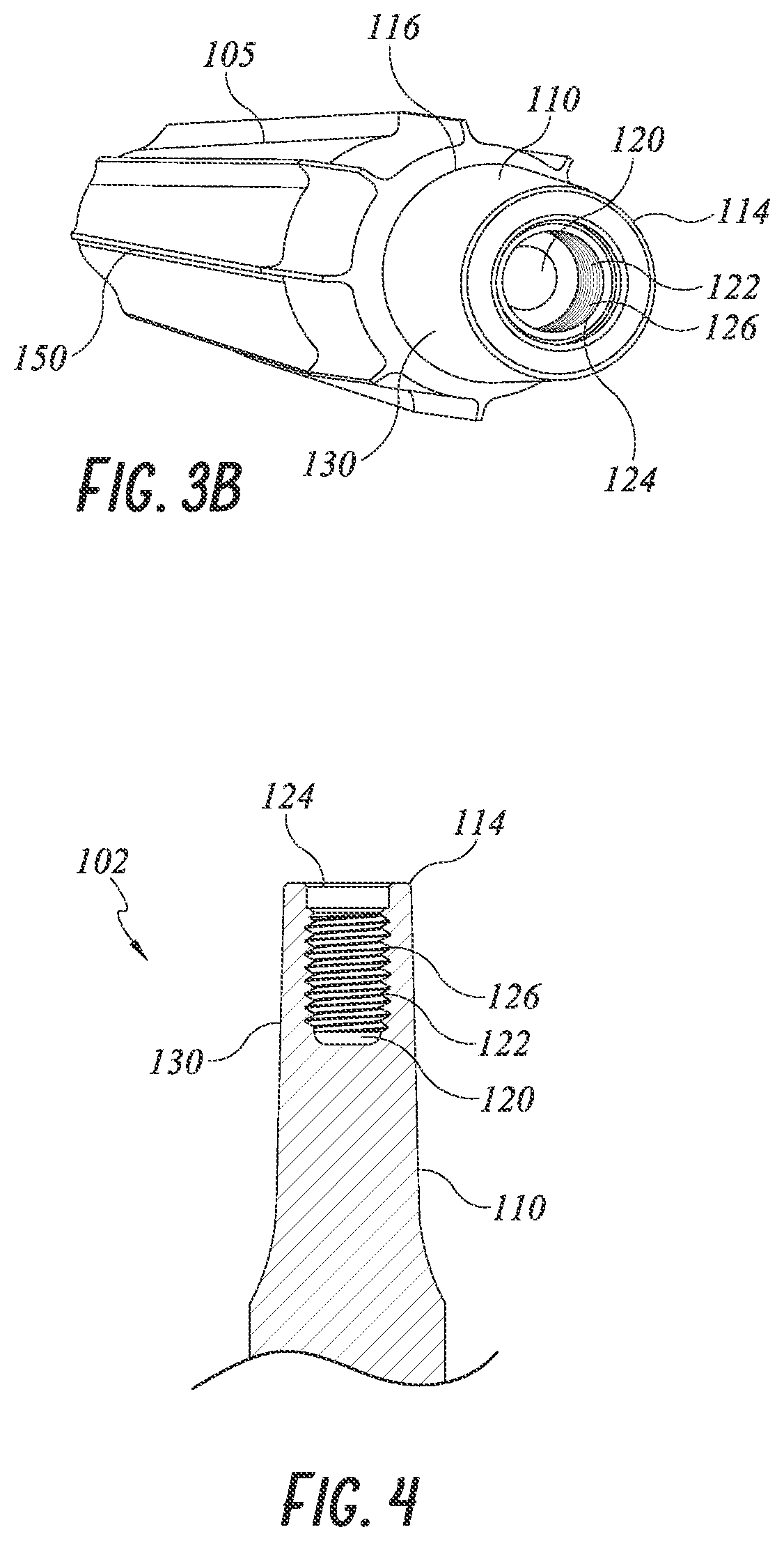 Patent US12097121 Figure 4 – Hip implant system