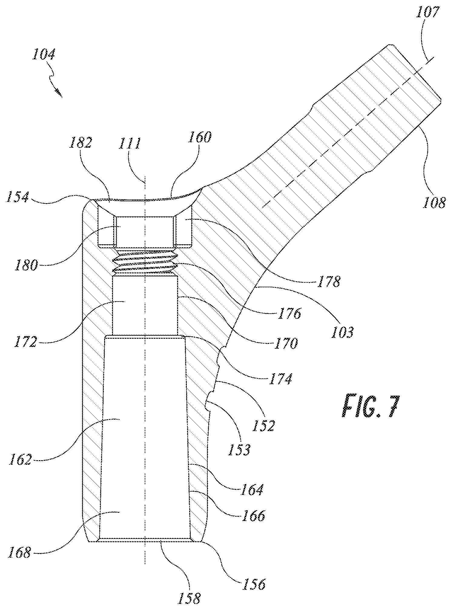 Patent US12097121 Figure 8 – Hip implant system