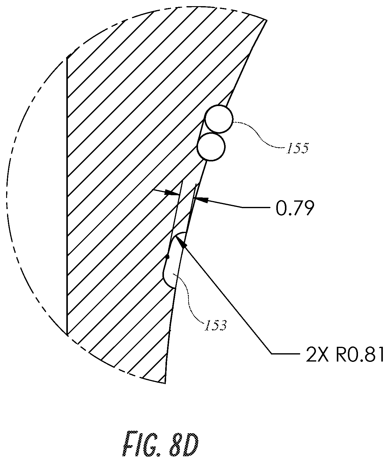 Patent US12097121 Figure 11 – Hip implant system