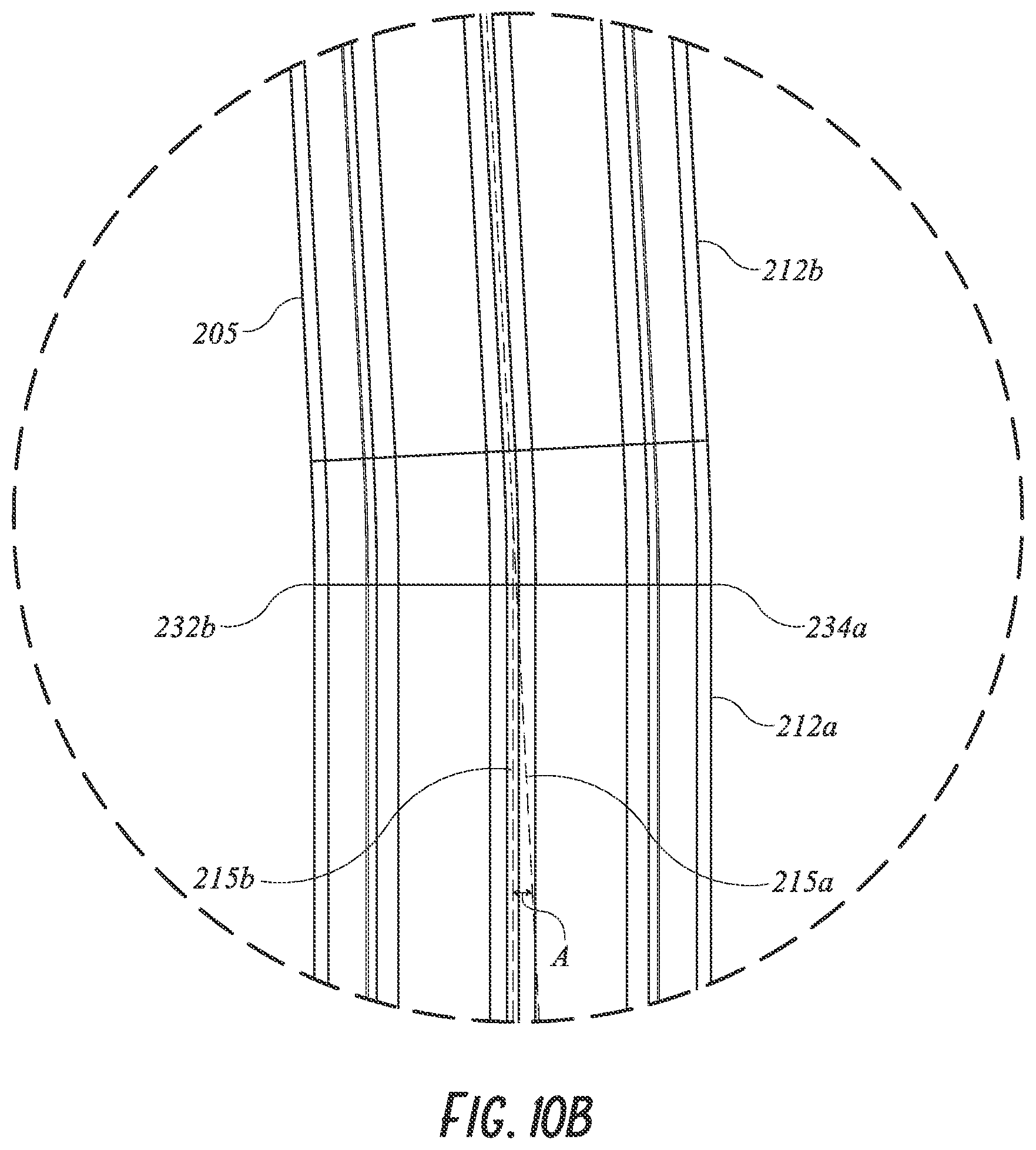 Patent US12097121 Figure 14 – Hip implant system