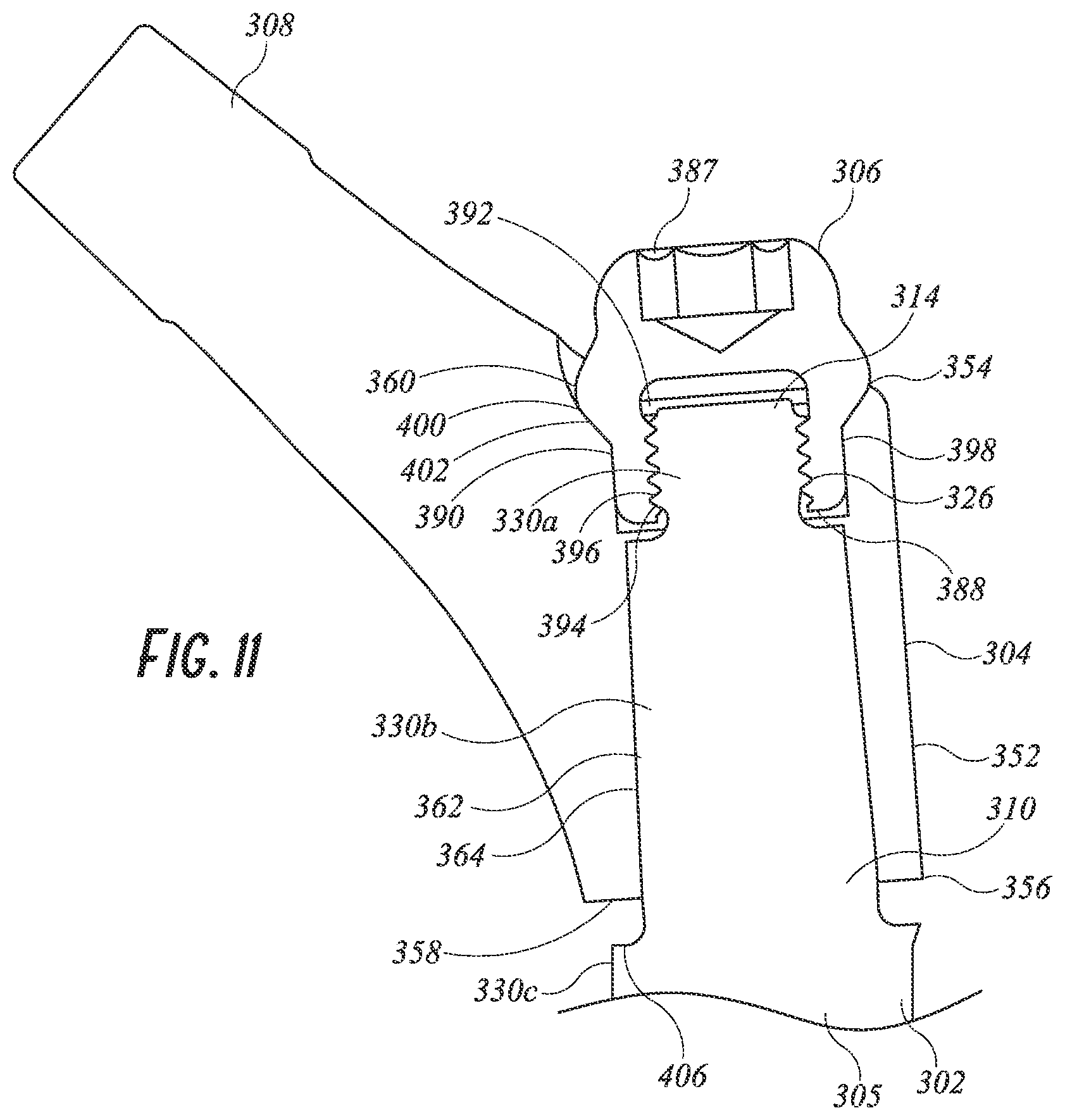 Patent US12097121 Figure 15 – Hip implant system