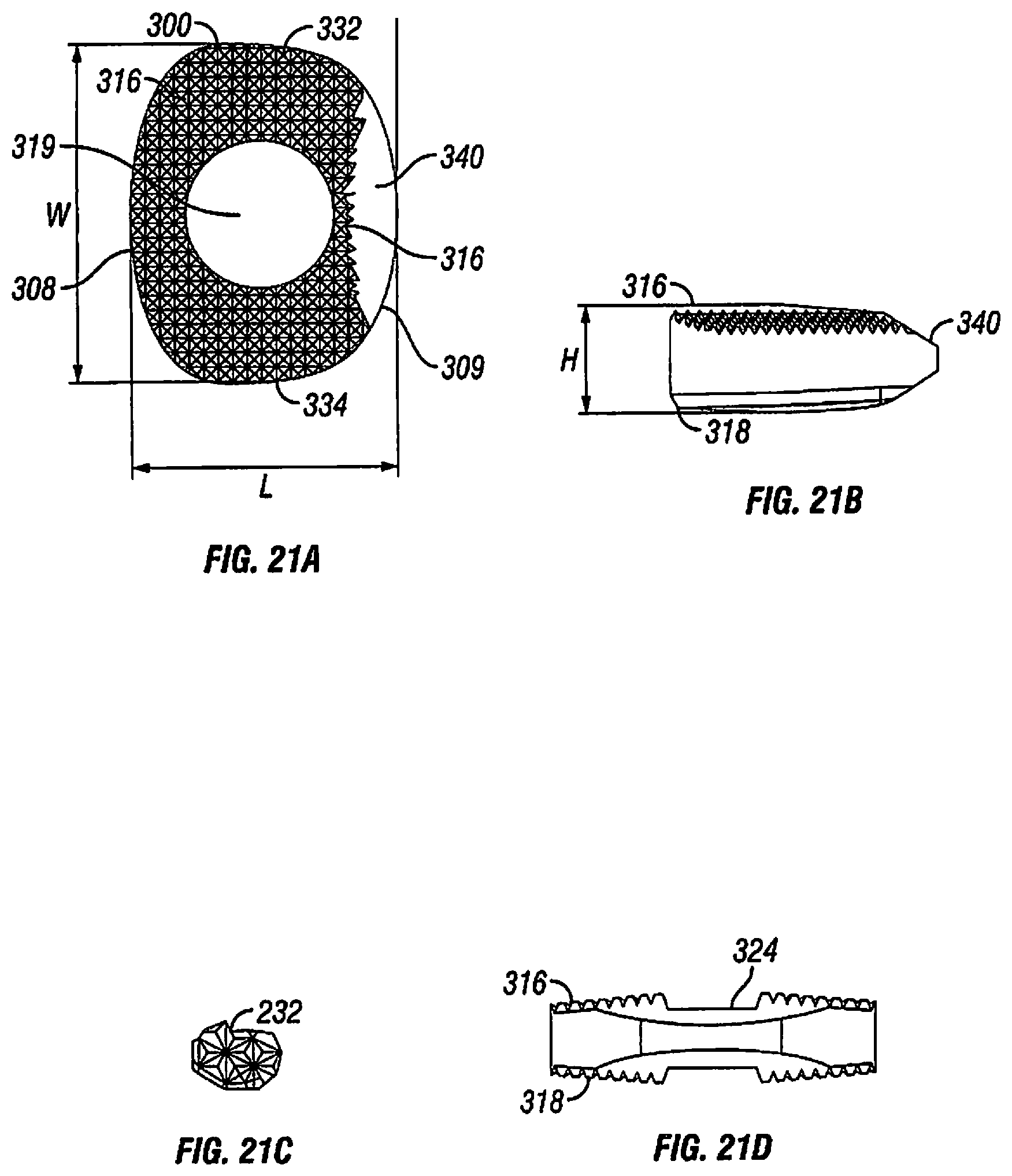 Patent US12097122 Figure 11 – Multi-piece intervertebral implants