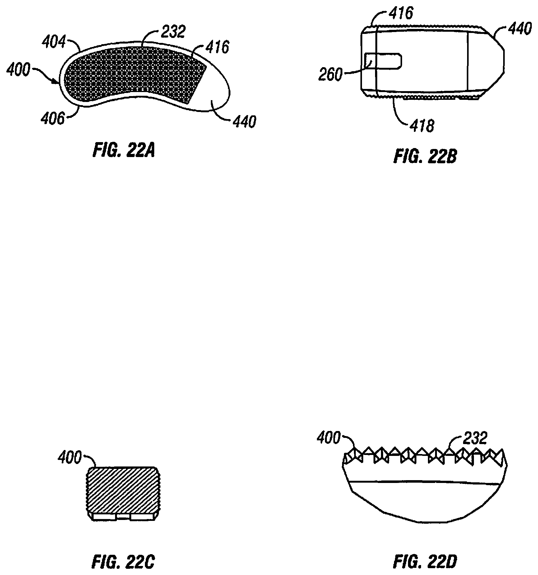 Patent US12097122 Figure 12 – Multi-piece intervertebral implants