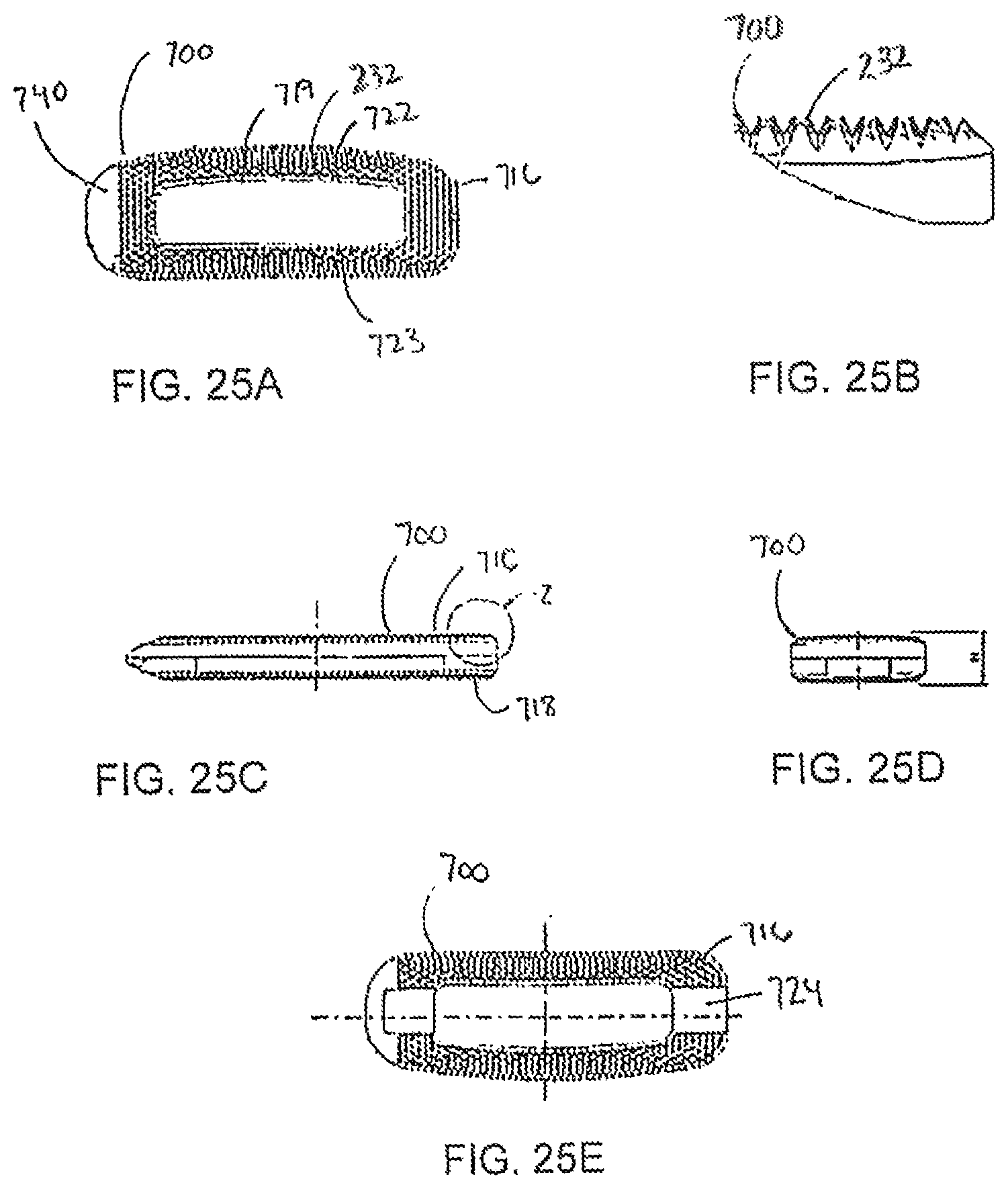 Patent US12097122 Figure 15 – Multi-piece intervertebral implants