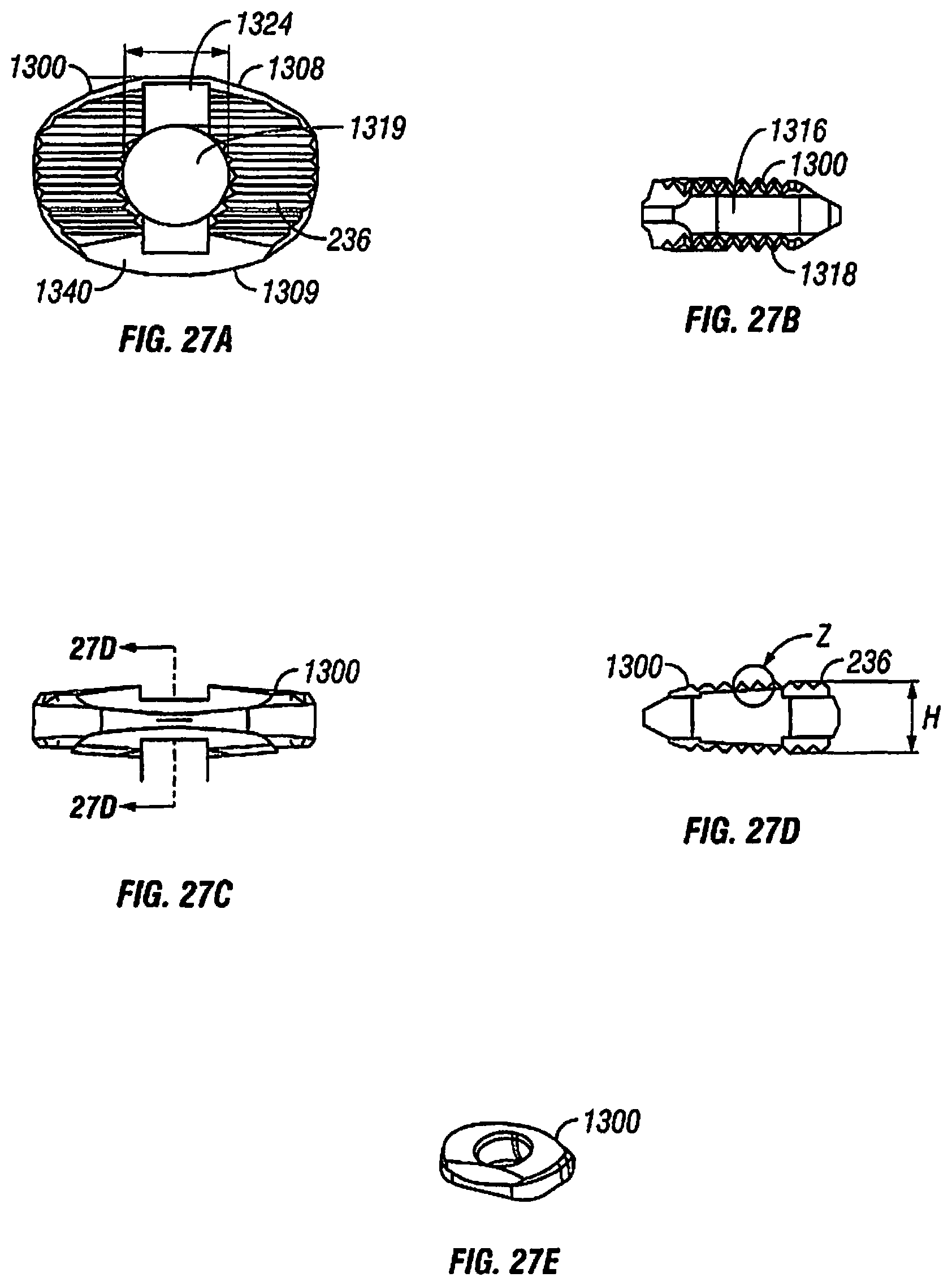 Patent US12097122 Figure 17 – Multi-piece intervertebral implants