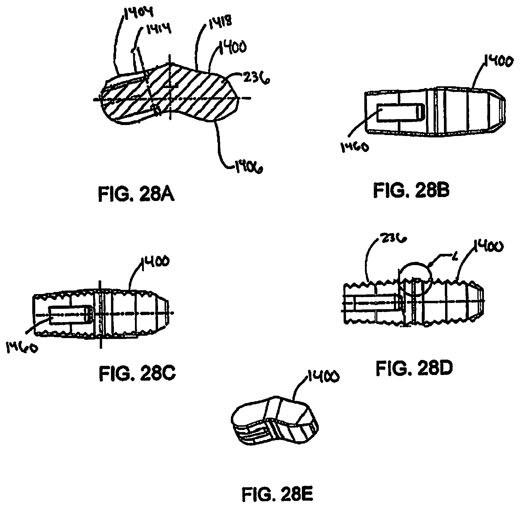 Patent US12097122 Figure 18 – Multi-piece intervertebral implants