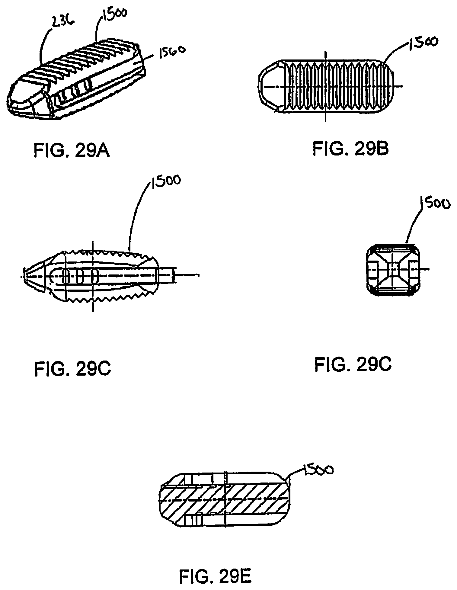 Patent US12097122 Figure 19 – Multi-piece intervertebral implants