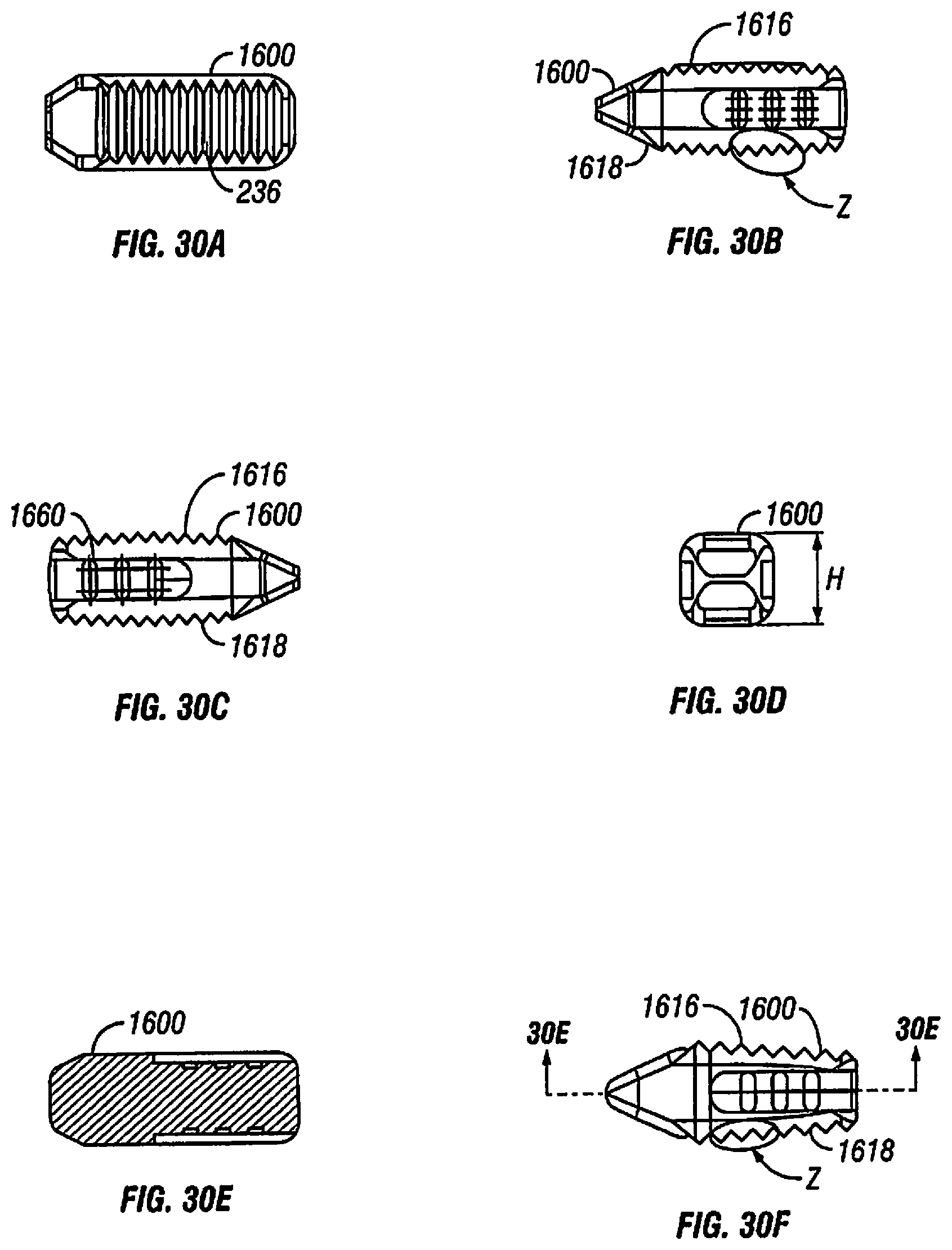 Patent US12097122 Figure 20 – Multi-piece intervertebral implants