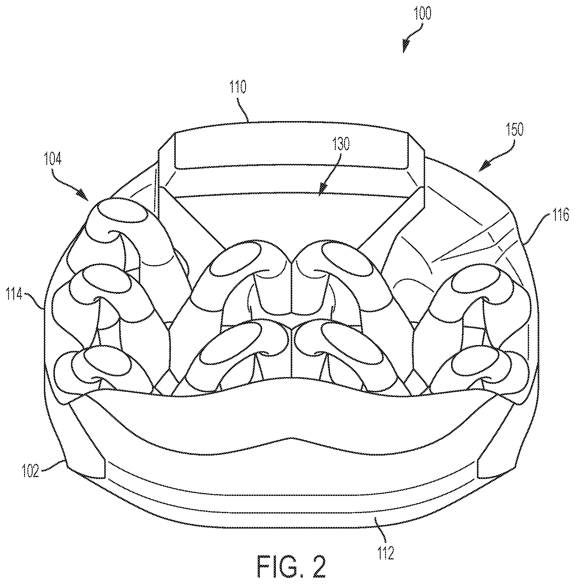 Patent US12097123 Figure 2 – Implant with arched bone contacting elements