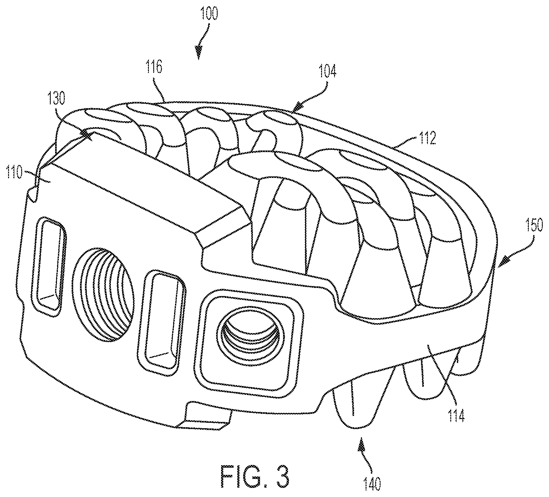 Patent US12097123 Figure 3 – Implant with arched bone contacting elements