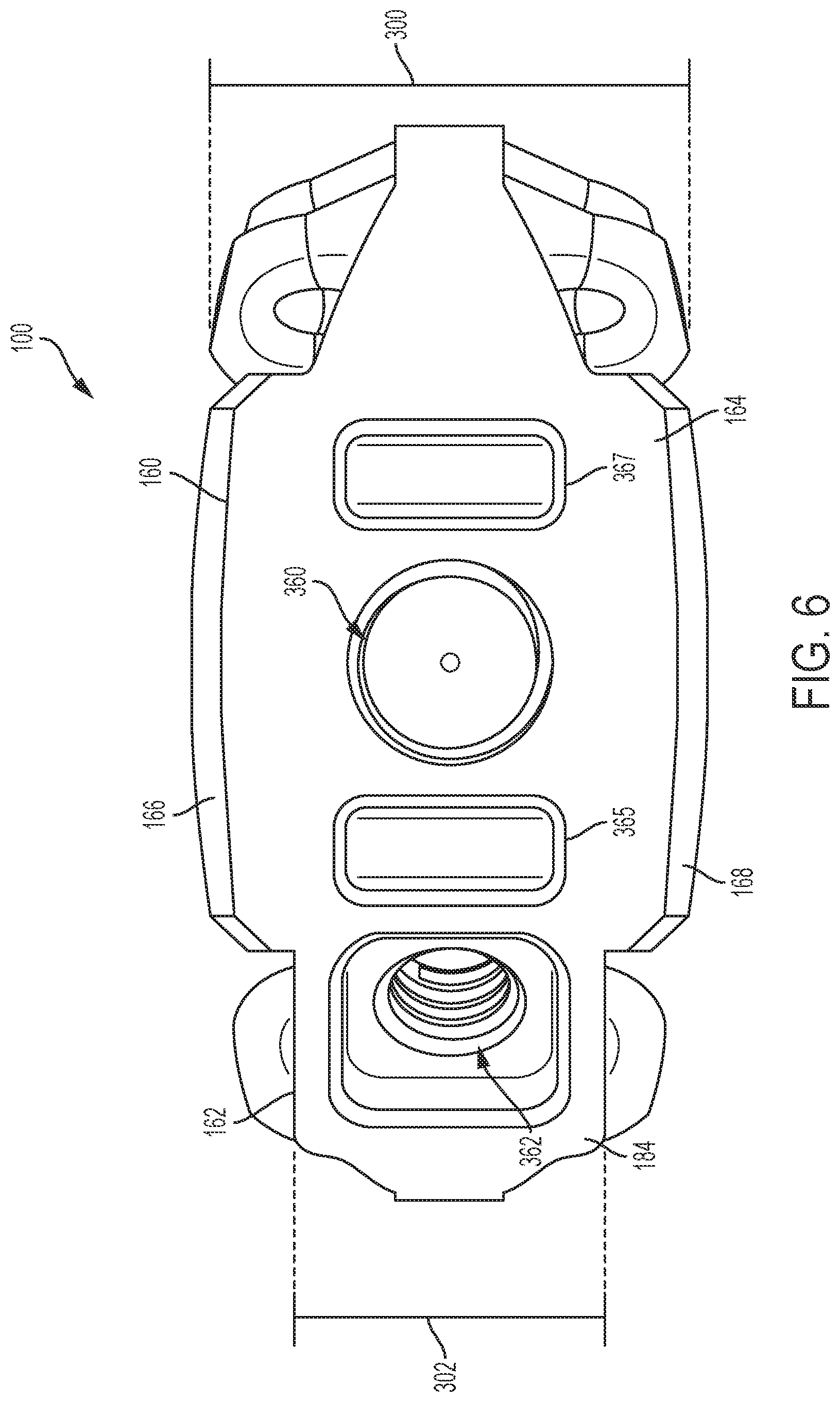 Patent US12097123 Figure 6 – Implant with arched bone contacting elements