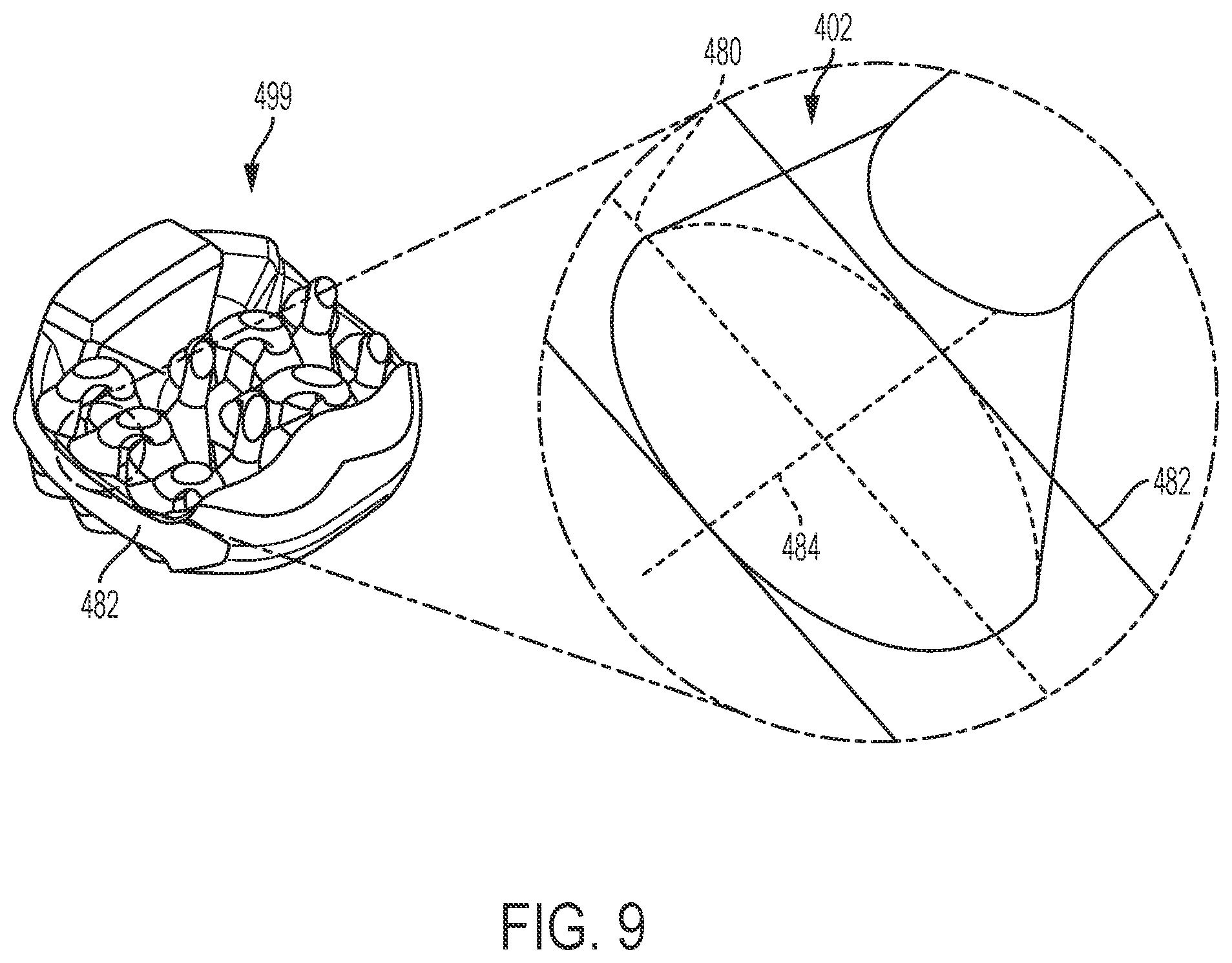 Patent US12097123 Figure 9 – Implant with arched bone contacting elements
