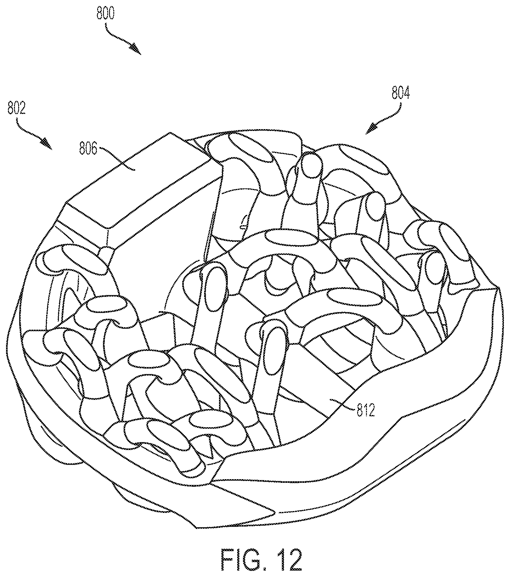 Patent US12097123 Figure 12 – Implant with arched bone contacting elements
