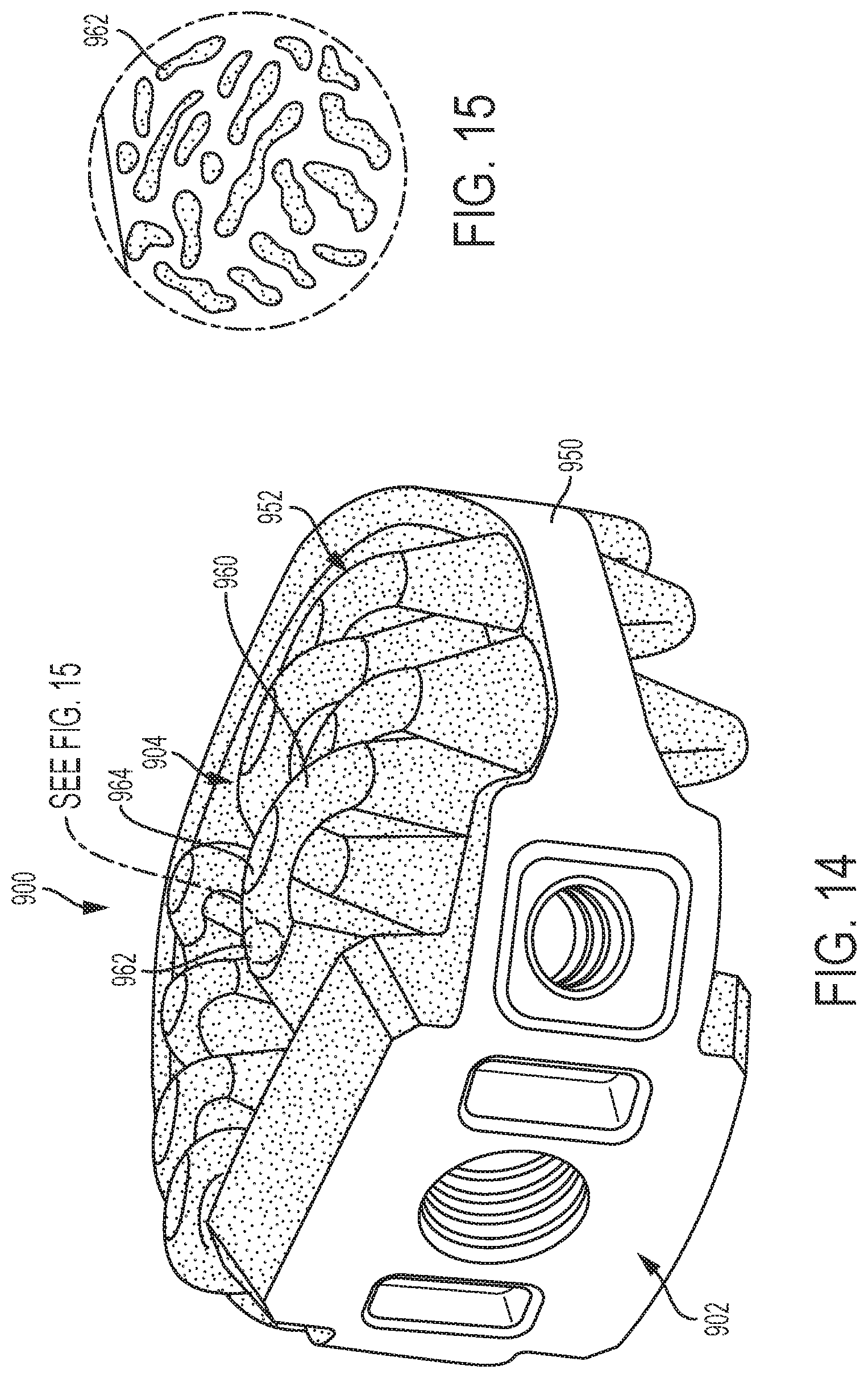 Patent US12097123 Figure 14 – Implant with arched bone contacting elements