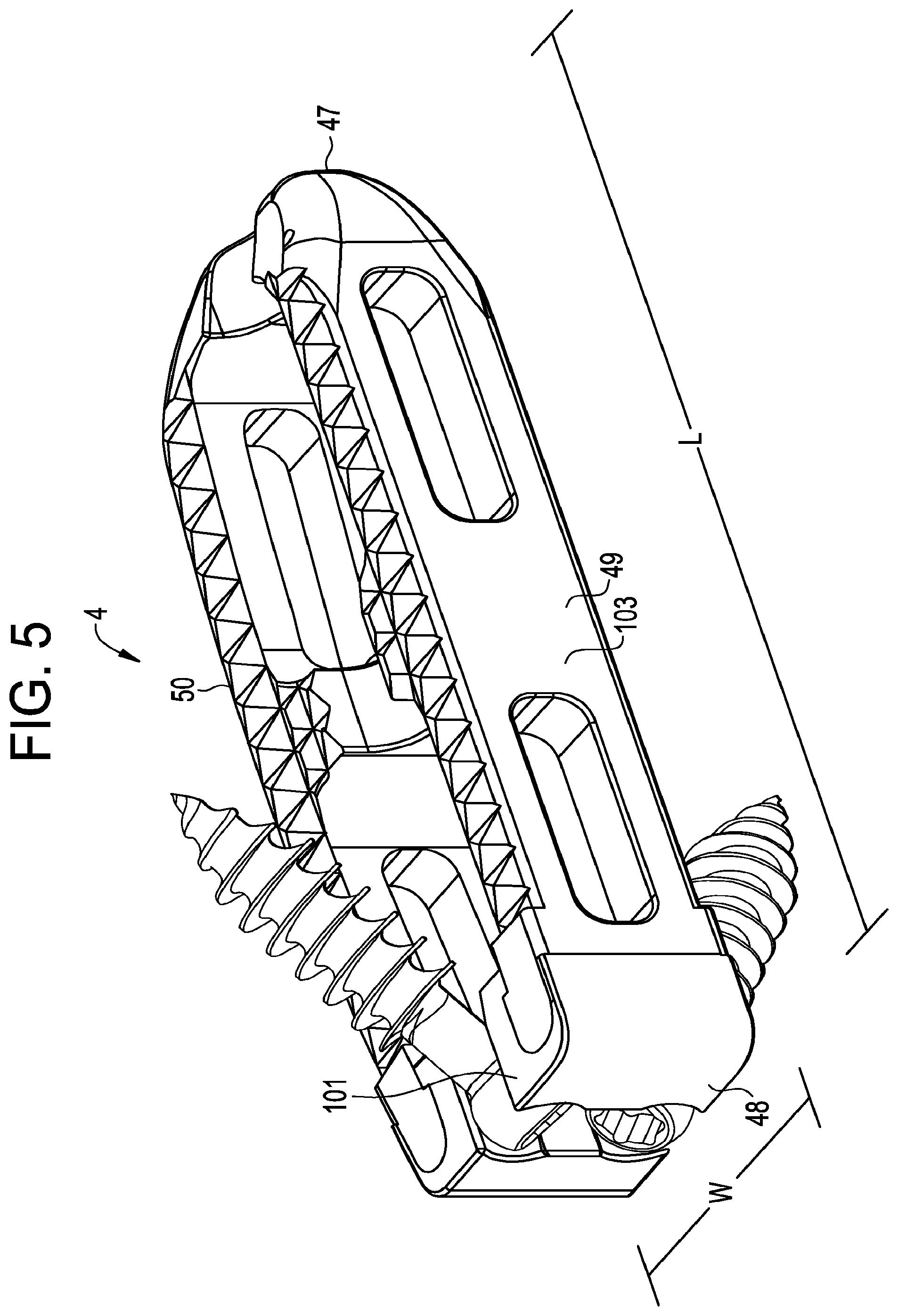 Patent US12097124 Figure 3 – Zero profile spinal fusion cage