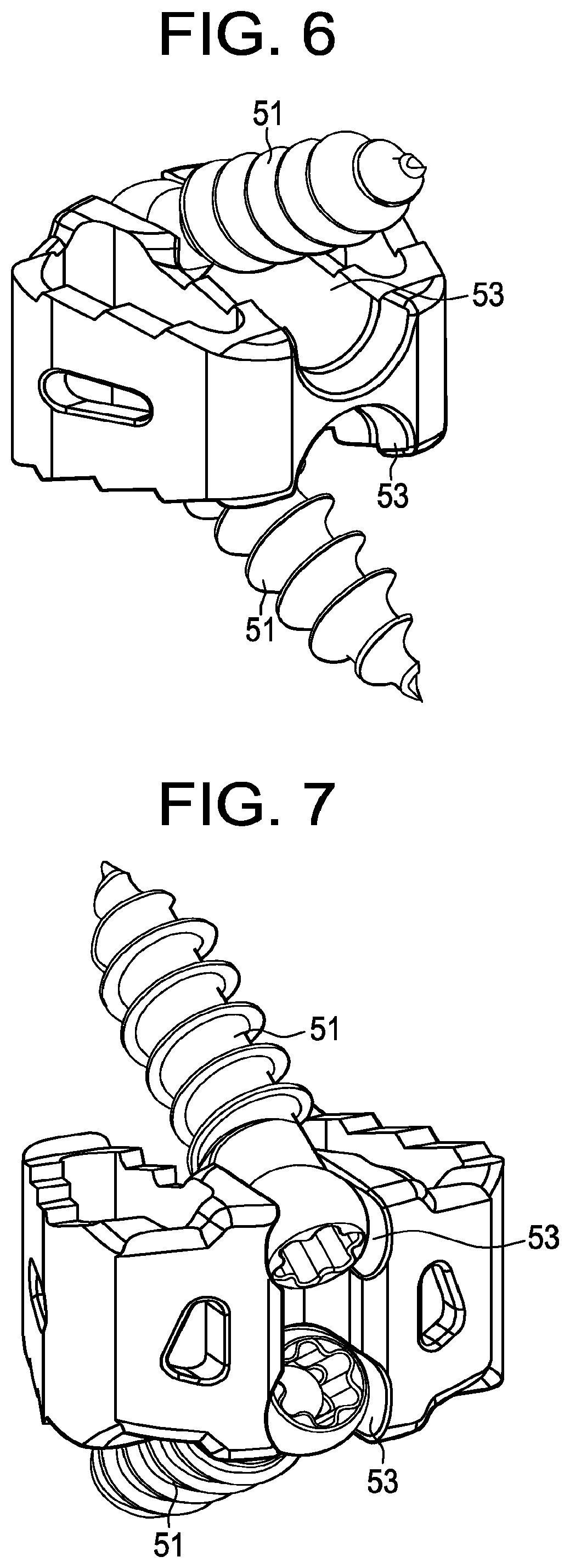 Patent US12097124 Figure 4 – Zero profile spinal fusion cage