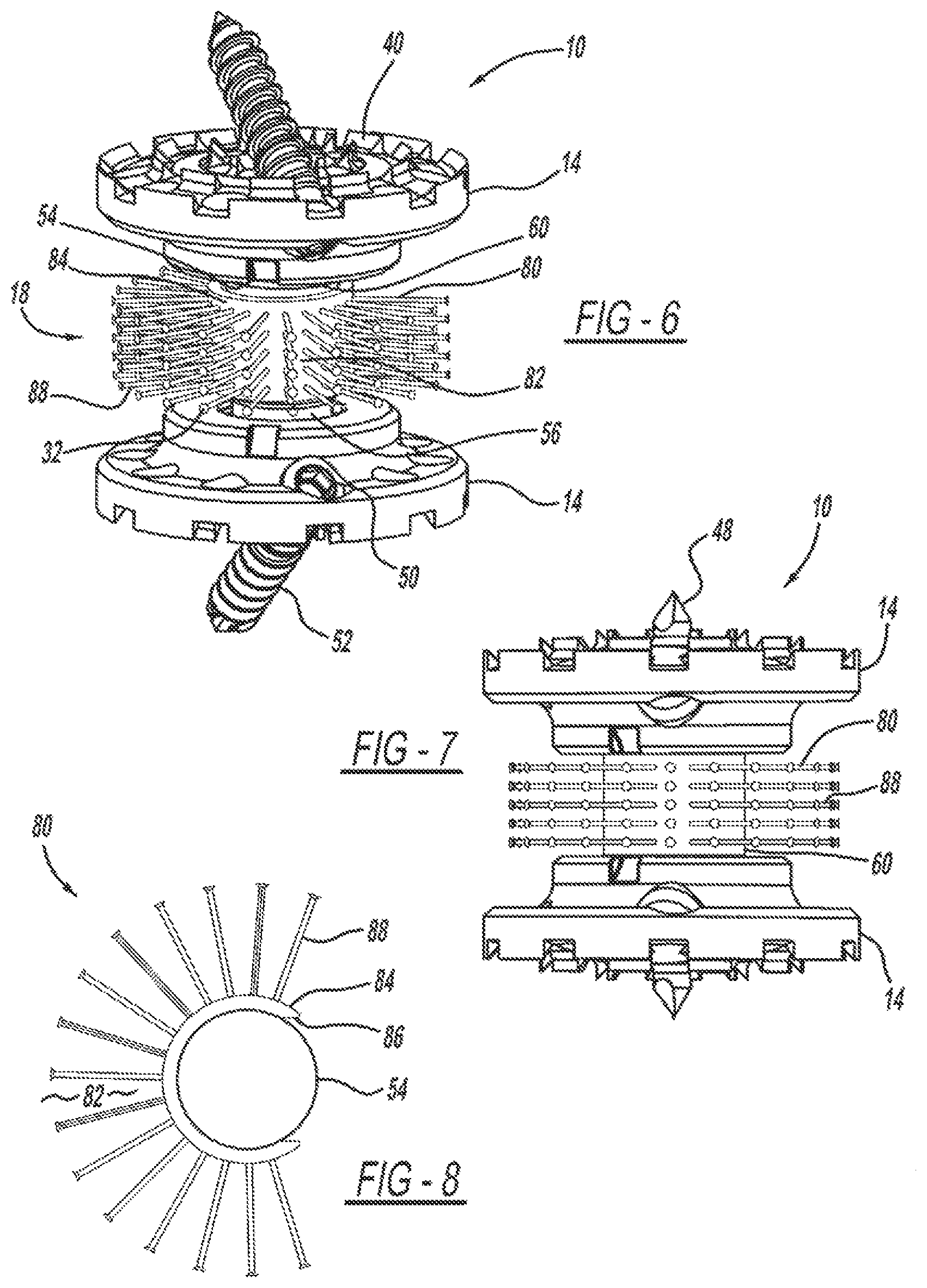 Patent US12097125 Figure 3 – Method and implant device for grafting adjacent vertebral bodies