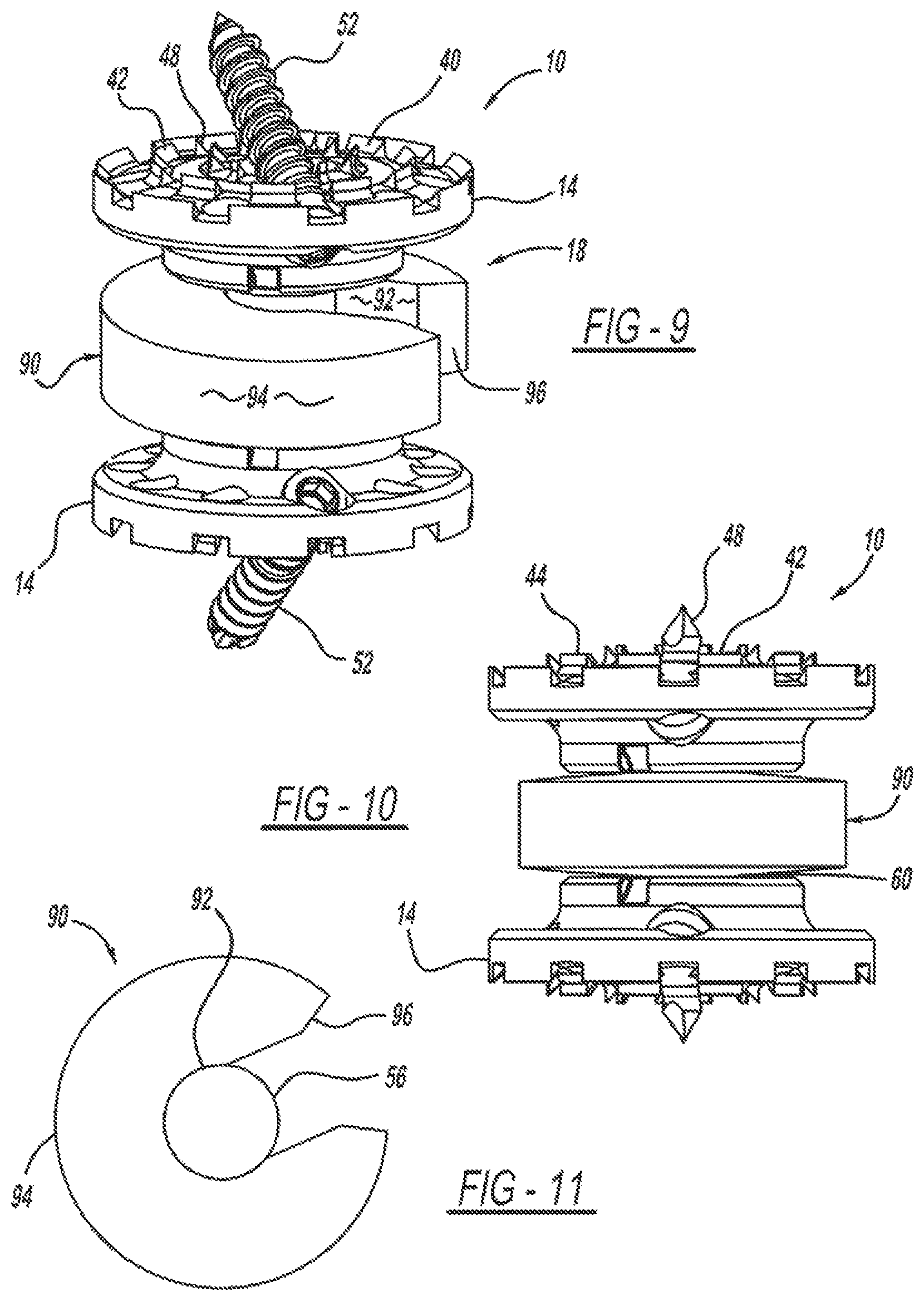Patent US12097125 Figure 4 – Method and implant device for grafting adjacent vertebral bodies