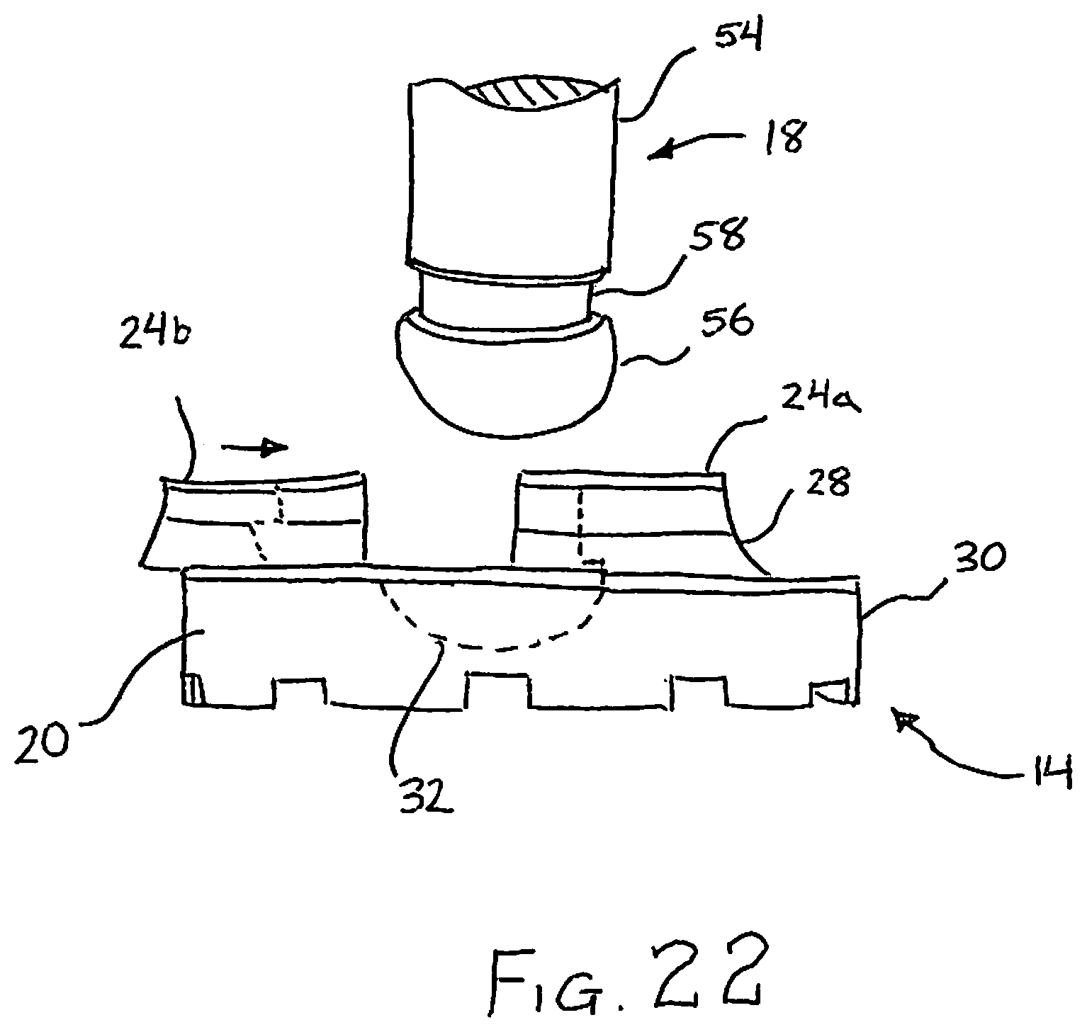 Patent US12097125 Figure 11 – Method and implant device for grafting adjacent vertebral bodies