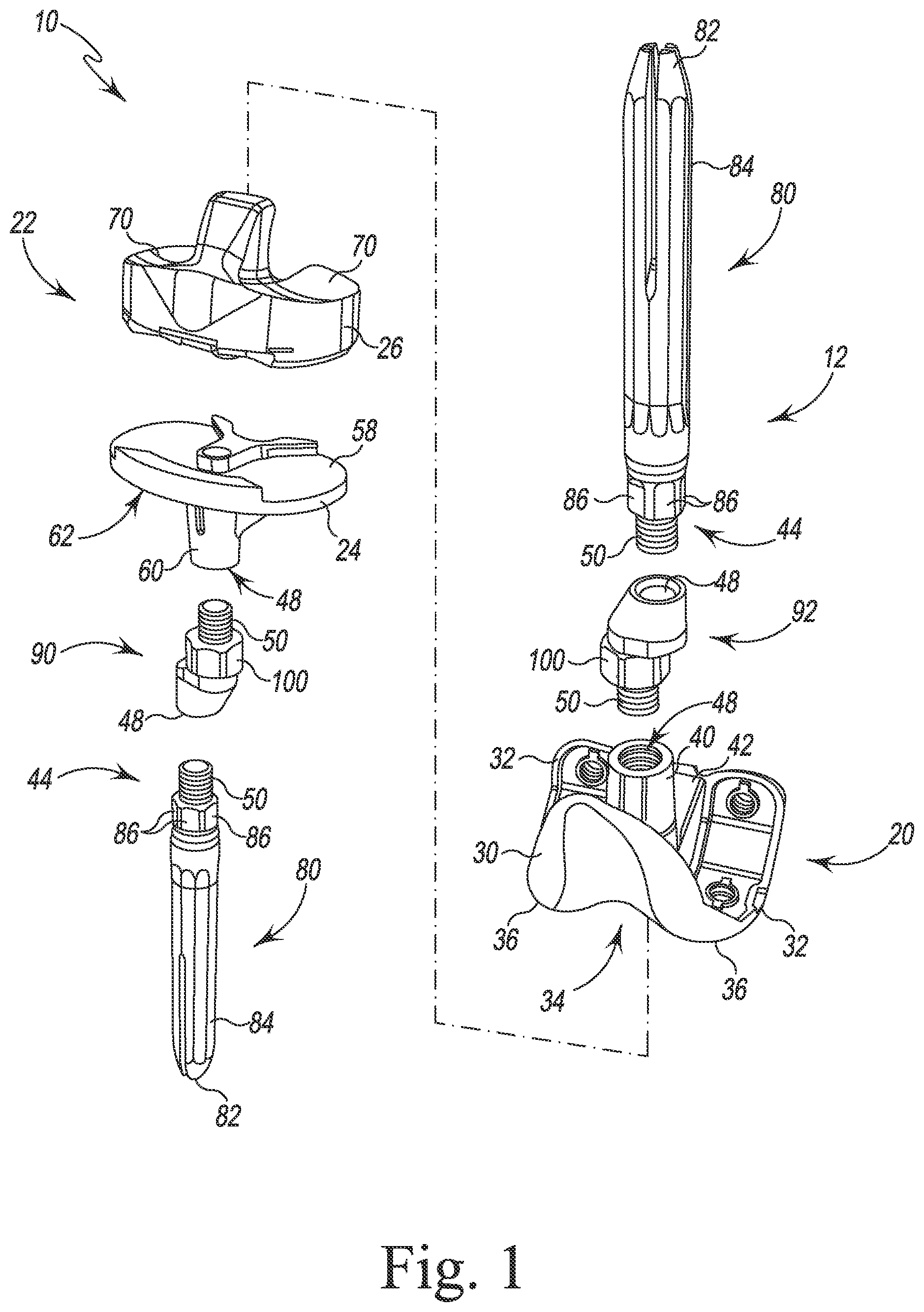 Patent US12097128 Figure 1 – System and method for preparing a patient's femur in an orthopaedic joint replacement procedure