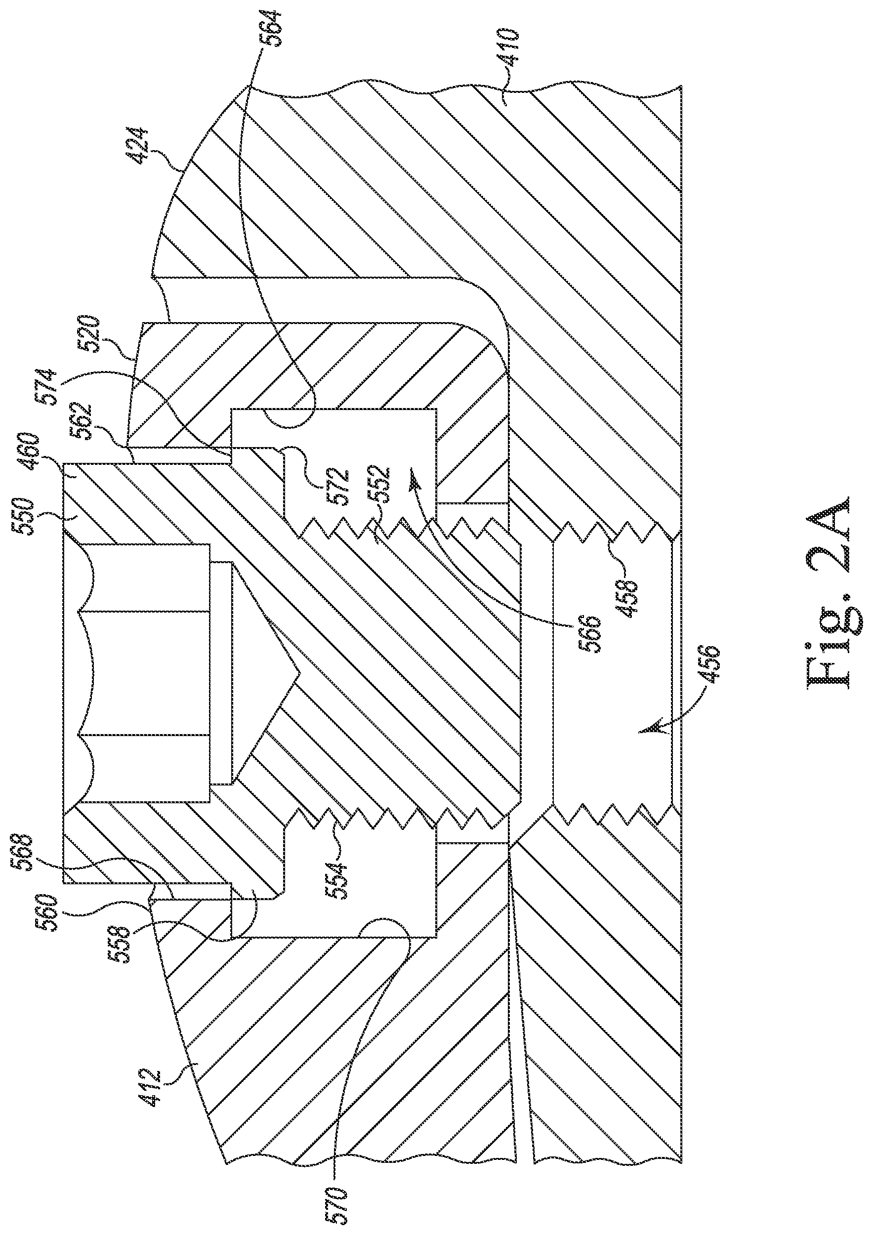 Patent US12097128 Figure 3 – System and method for preparing a patient's femur in an orthopaedic joint replacement procedure