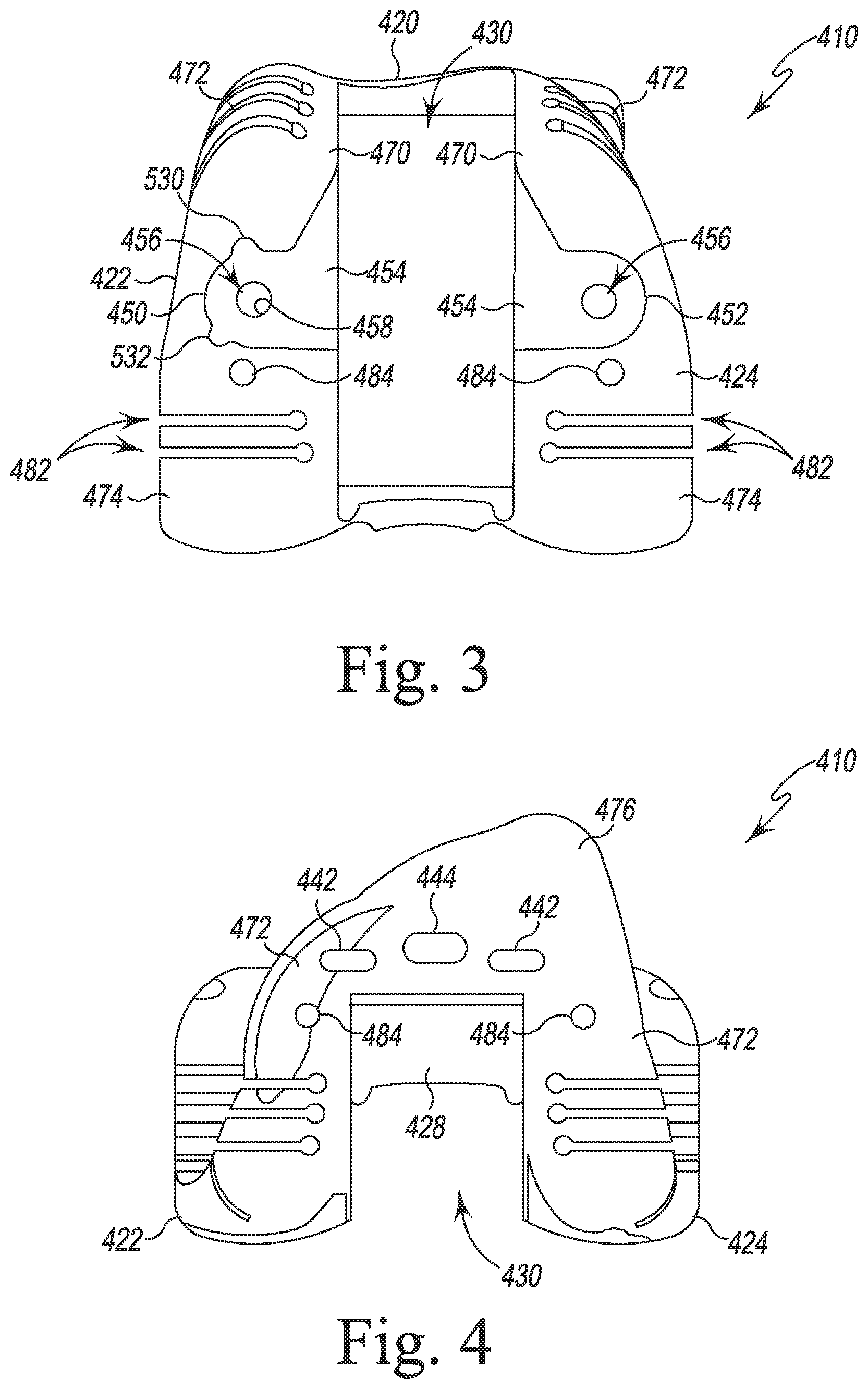 Patent US12097128 Figure 4 – System and method for preparing a patient's femur in an orthopaedic joint replacement procedure