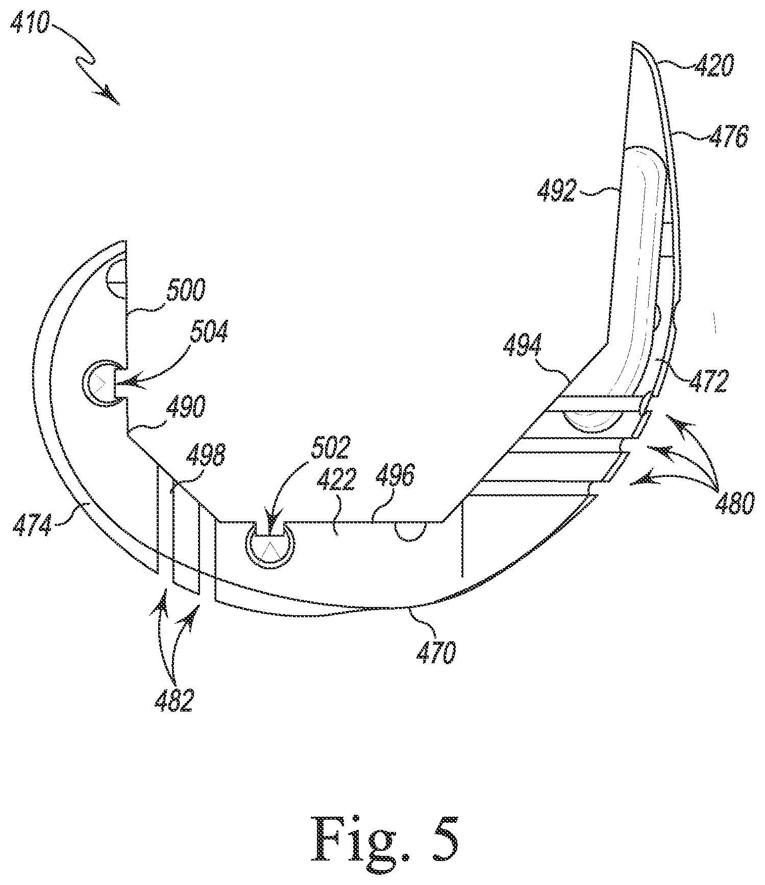 Patent US12097128 Figure 5 – System and method for preparing a patient's femur in an orthopaedic joint replacement procedure