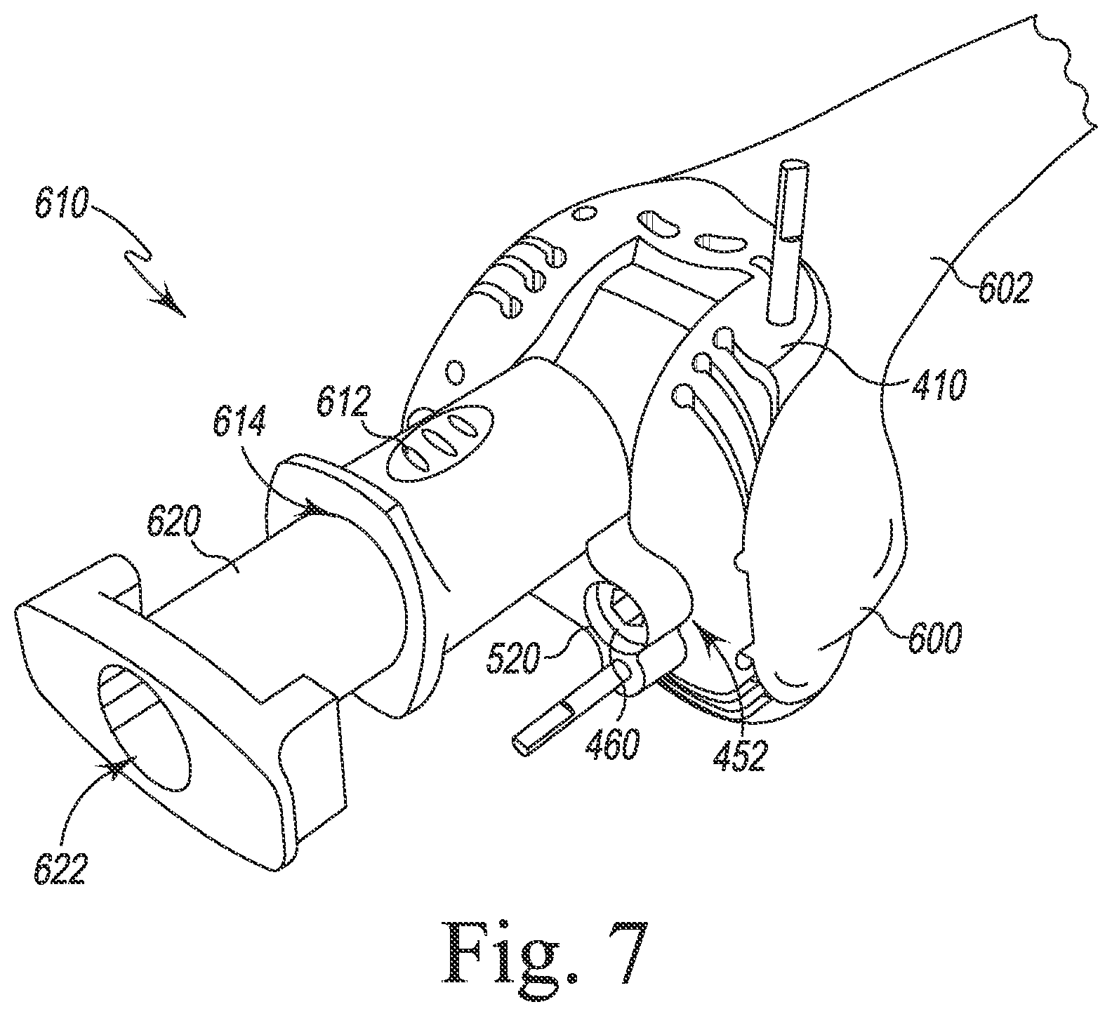 Patent US12097128 Figure 7 – System and method for preparing a patient's femur in an orthopaedic joint replacement procedure