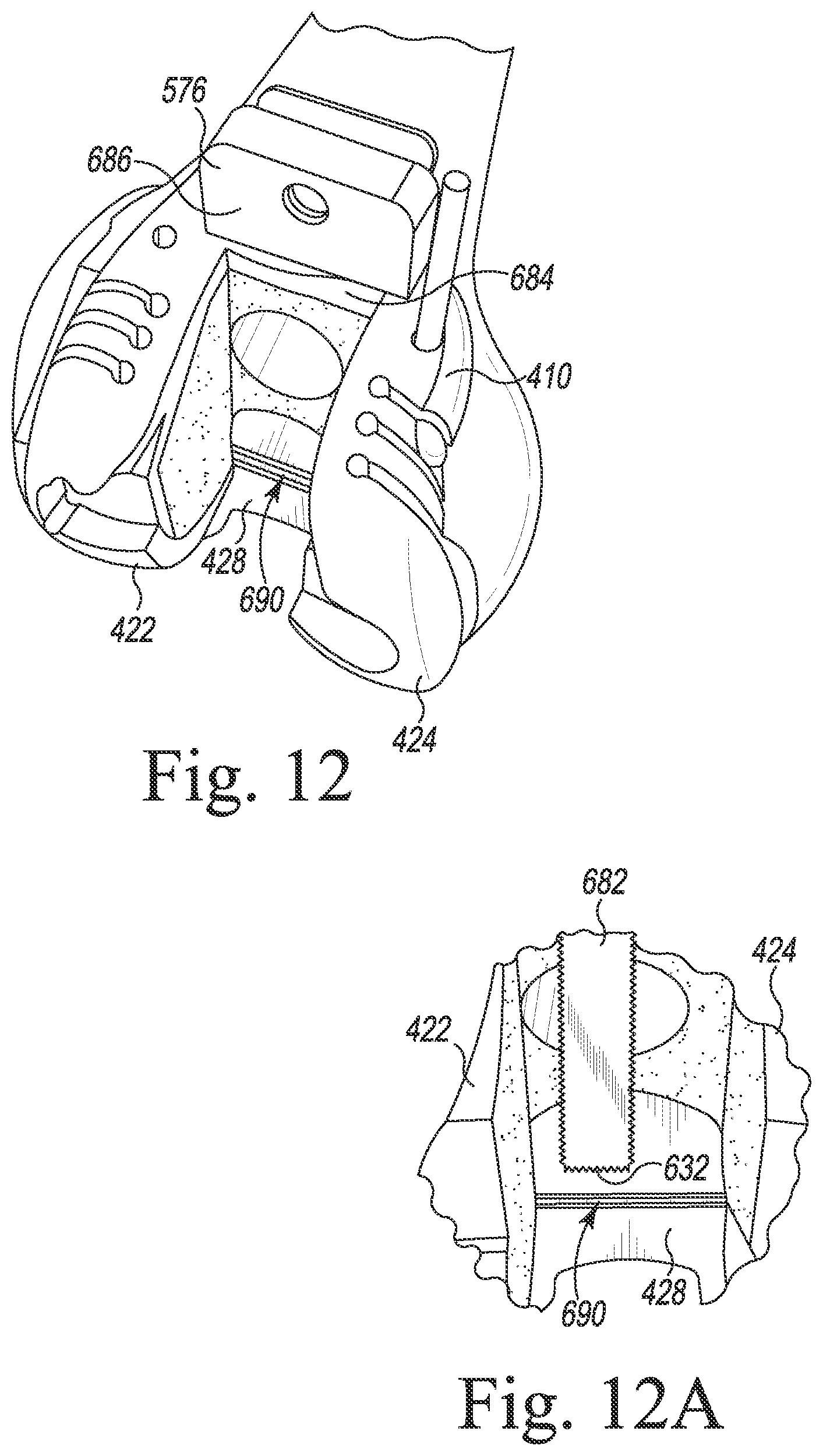 Patent US12097128 Figure 13 – System and method for preparing a patient's femur in an orthopaedic joint replacement procedure