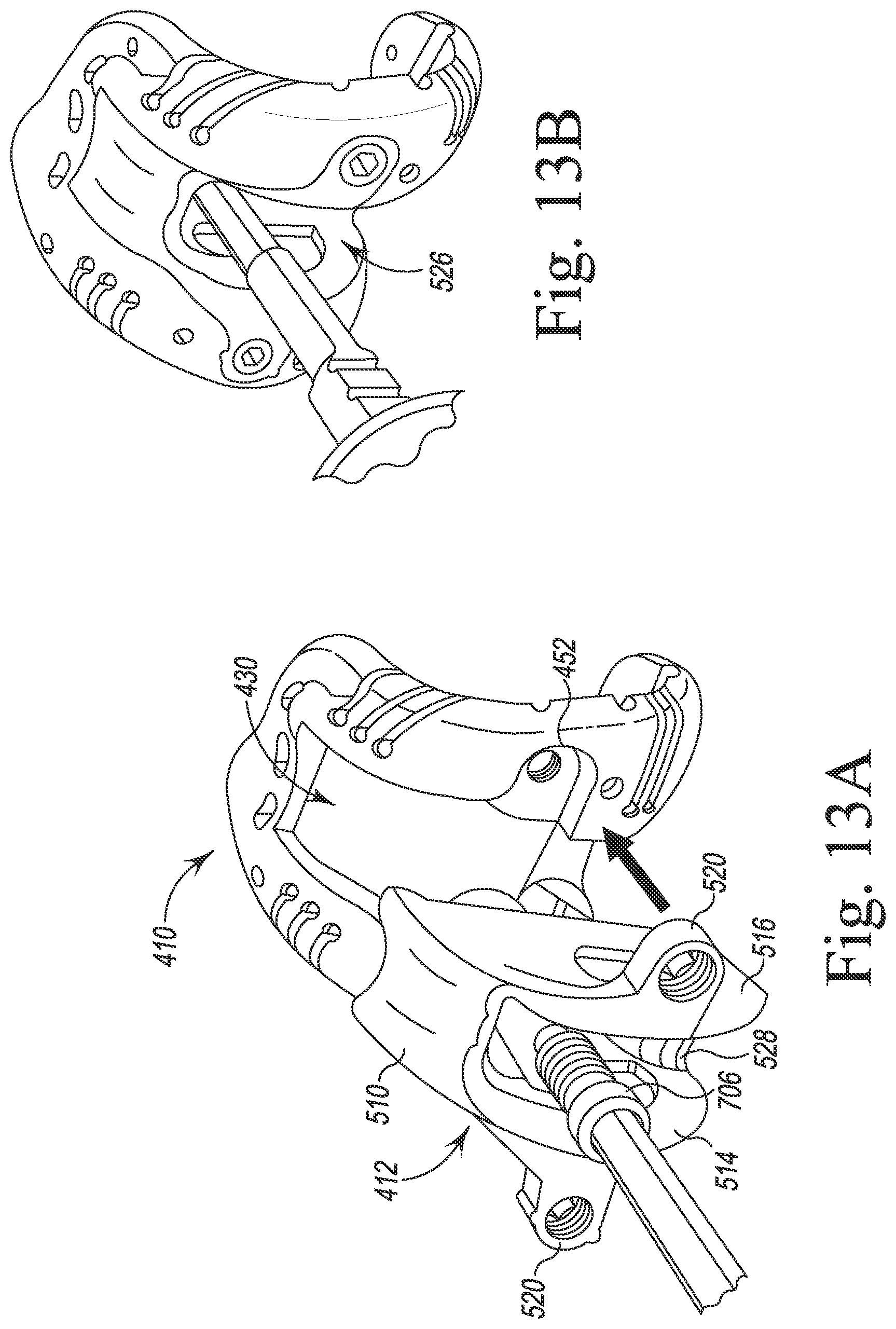 Patent US12097128 Figure 14 – System and method for preparing a patient's femur in an orthopaedic joint replacement procedure