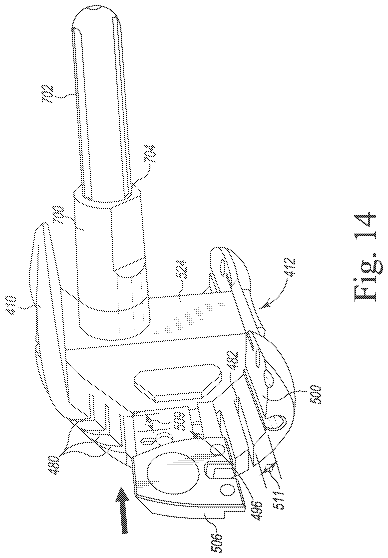 Patent US12097128 Figure 15 – System and method for preparing a patient's femur in an orthopaedic joint replacement procedure
