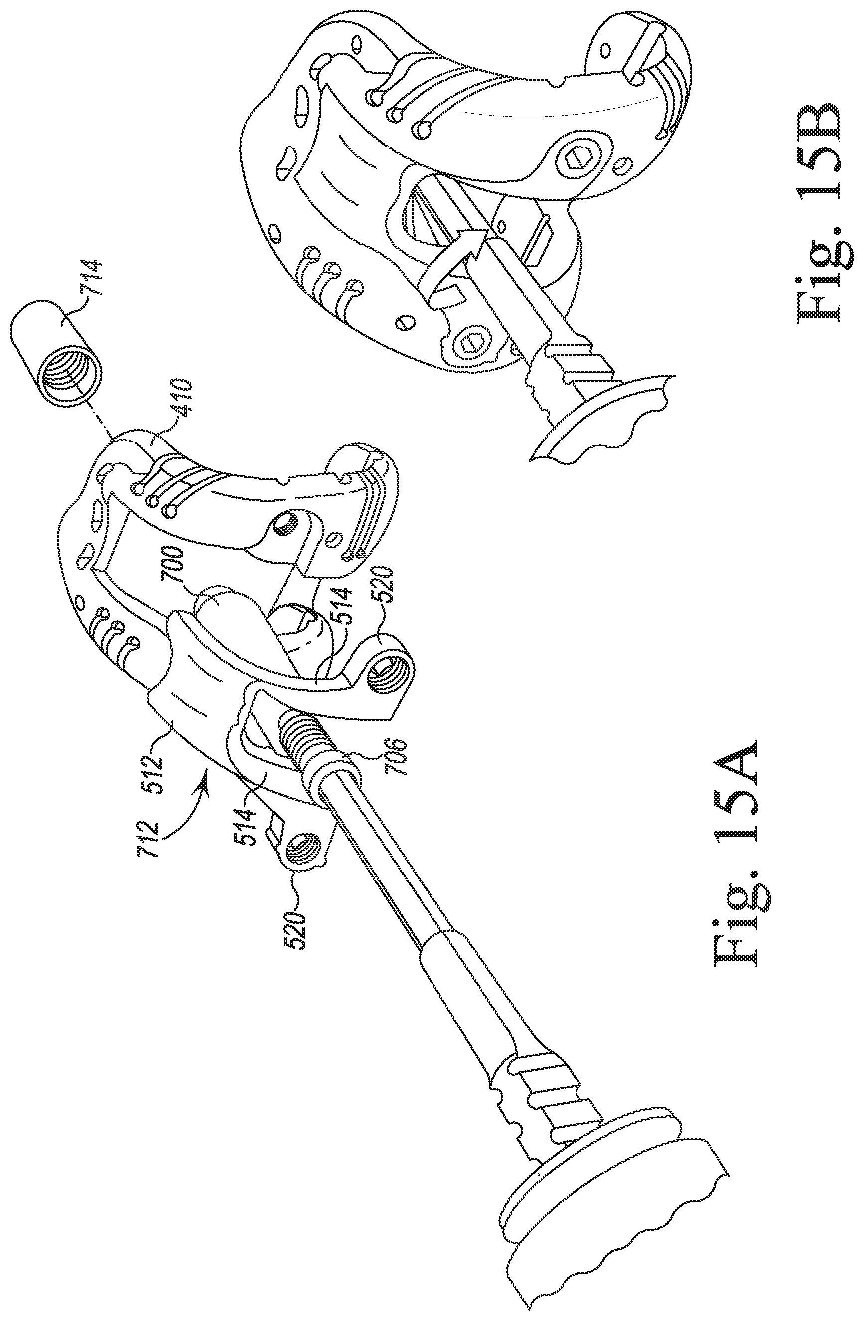Patent US12097128 Figure 16 – System and method for preparing a patient's femur in an orthopaedic joint replacement procedure