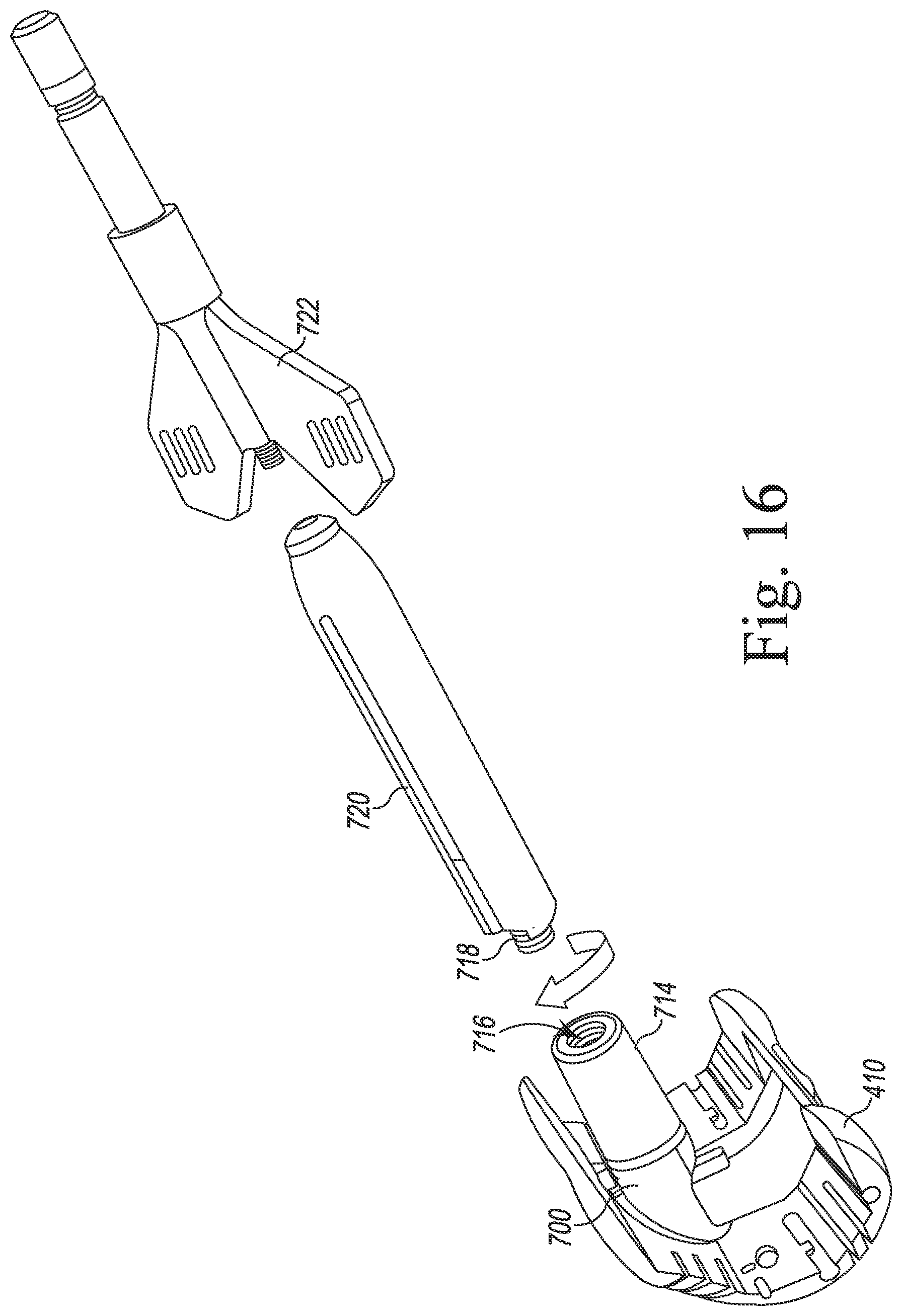 Patent US12097128 Figure 17 – System and method for preparing a patient's femur in an orthopaedic joint replacement procedure
