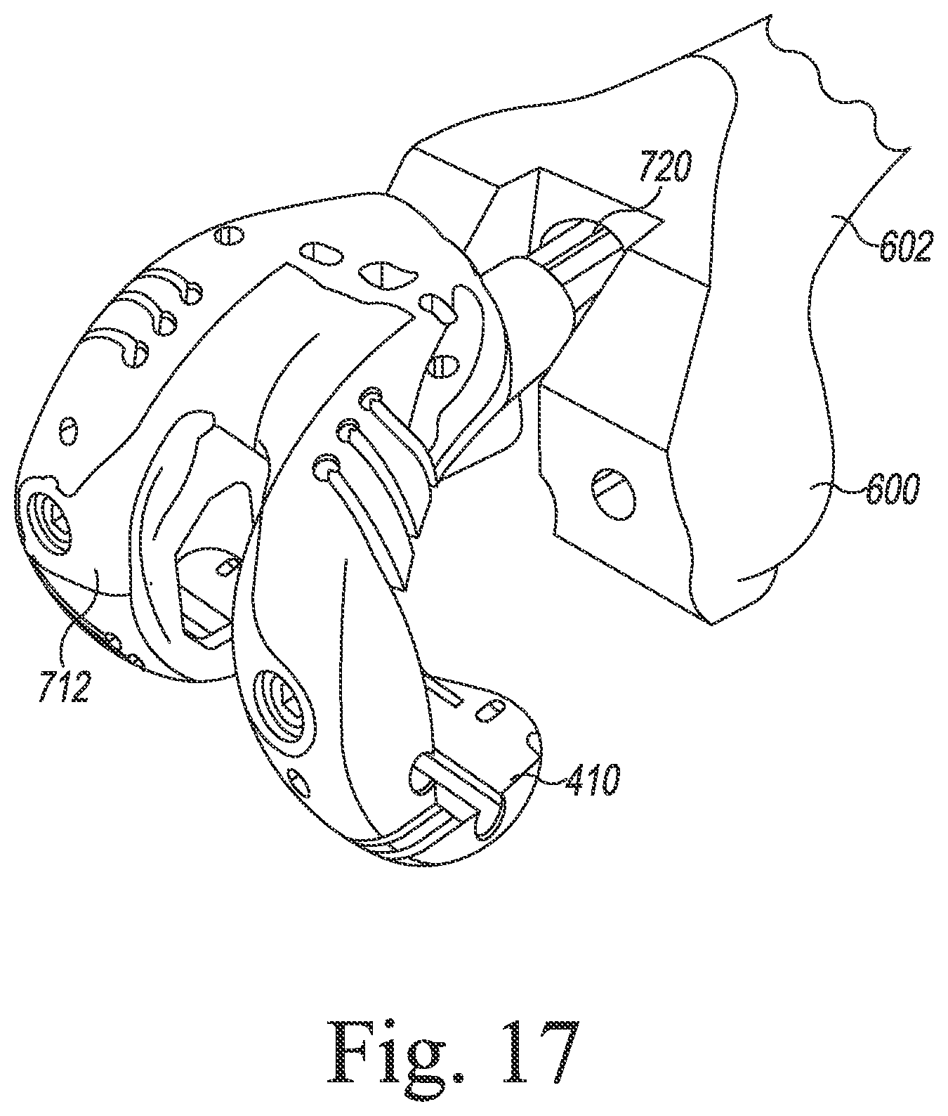 Patent US12097128 Figure 18 – System and method for preparing a patient's femur in an orthopaedic joint replacement procedure