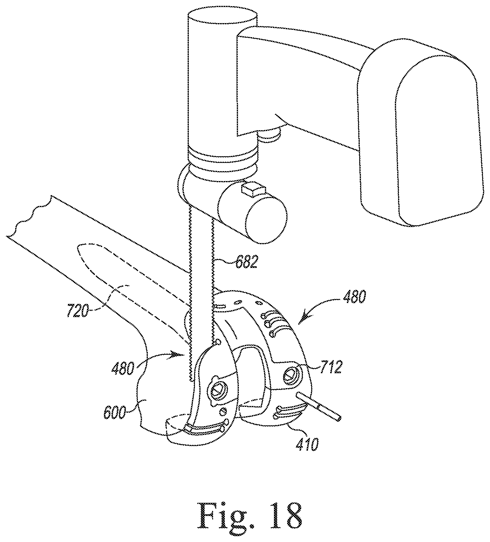 Patent US12097128 Figure 19 – System and method for preparing a patient's femur in an orthopaedic joint replacement procedure