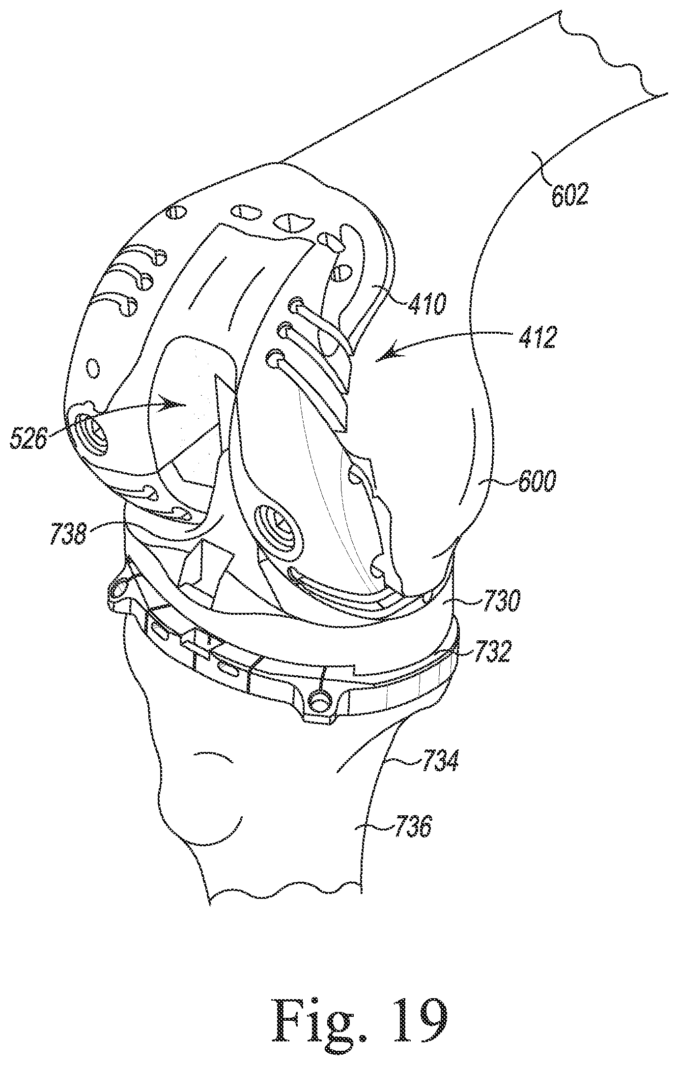 Patent US12097128 Figure 20 – System and method for preparing a patient's femur in an orthopaedic joint replacement procedure