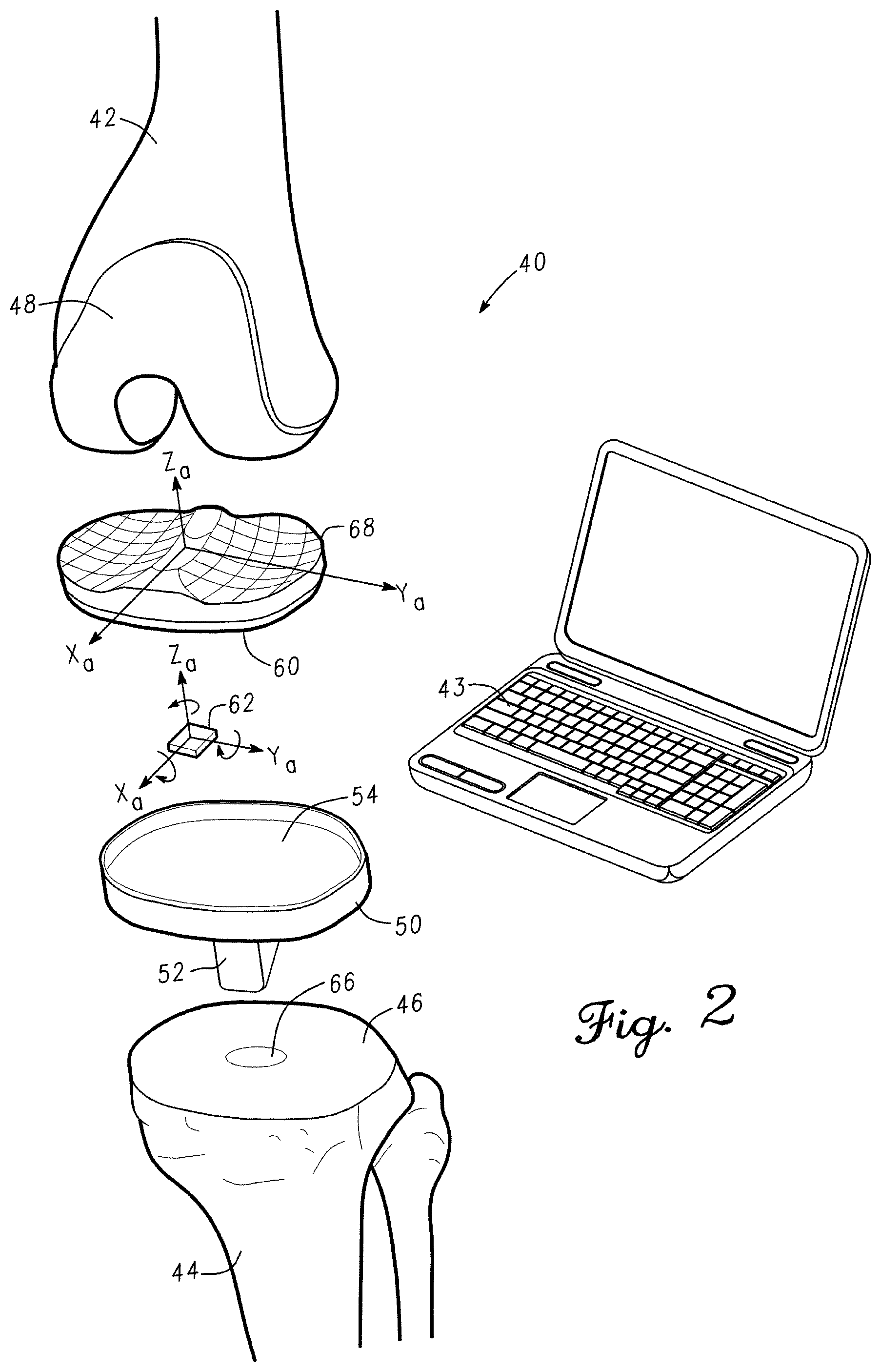 Patent US12097130 Figure 2 – Orthopedic leg alignment system and method