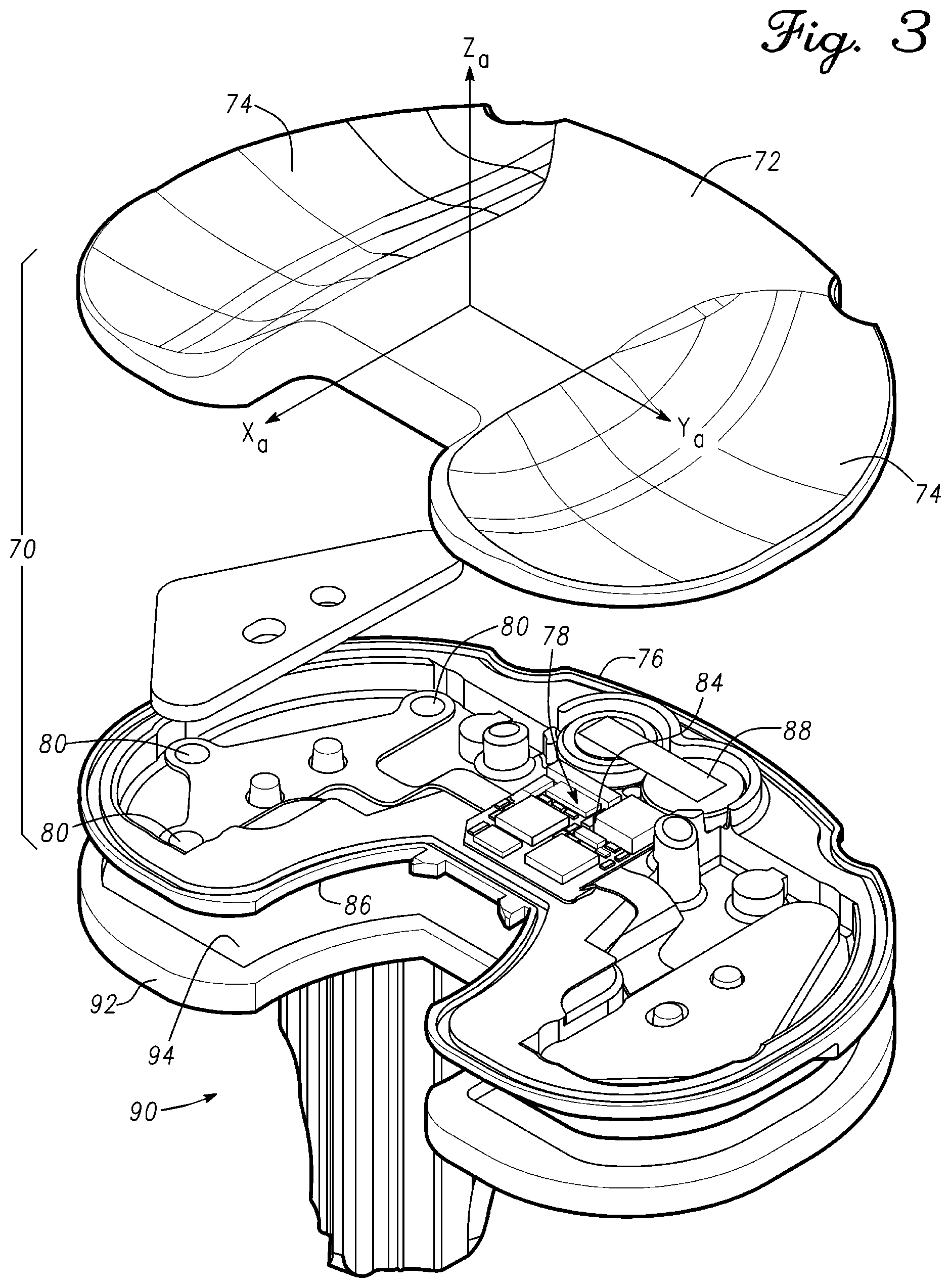 Patent US12097130 Figure 3 – Orthopedic leg alignment system and method